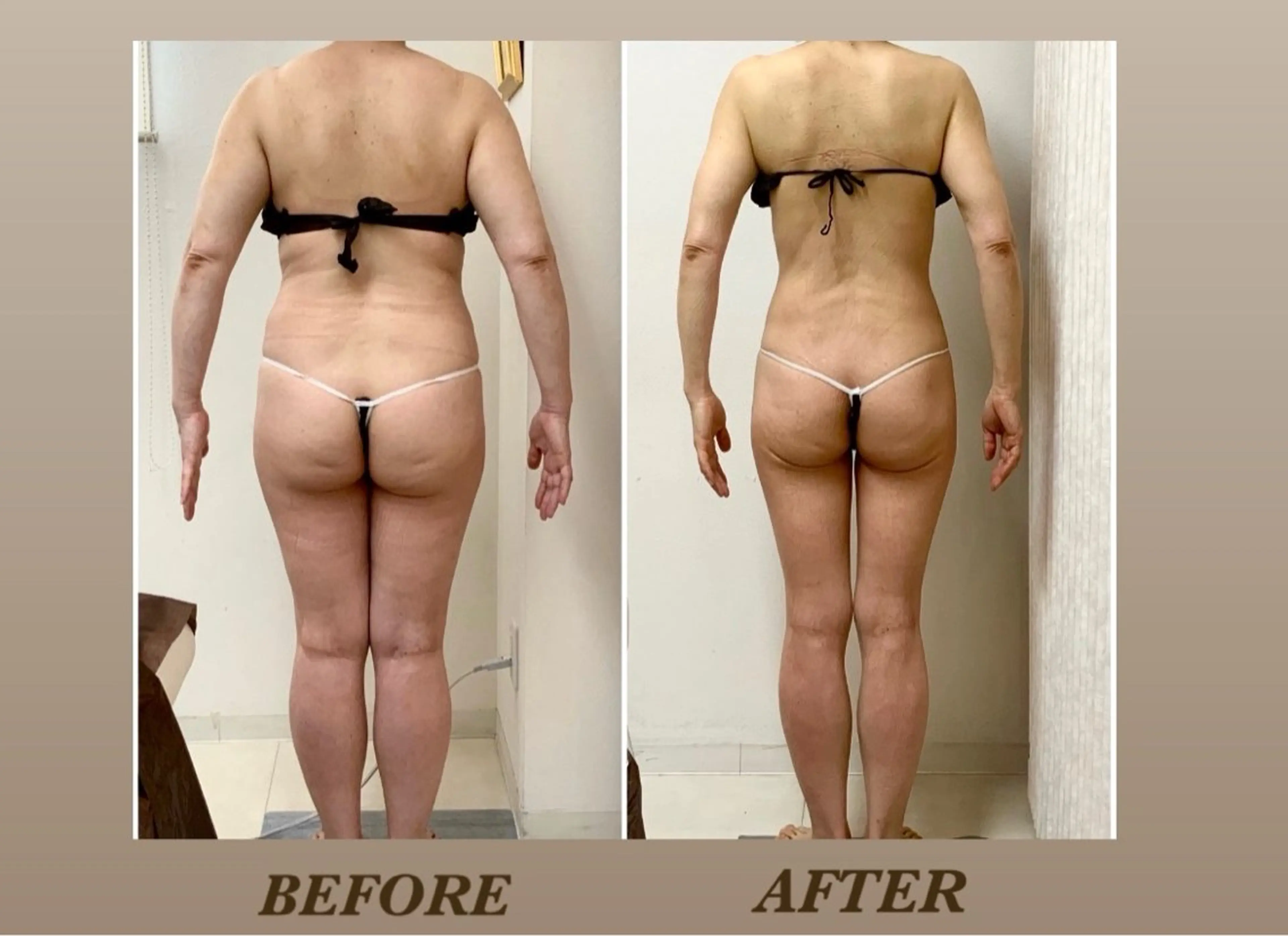 美BODY応援📣全身本気痩今だけ❤️🔥❤️🔥🔥90分¥6,900/脂肪・セル撃退/骨格矯正/姿勢矯正 💪の写真