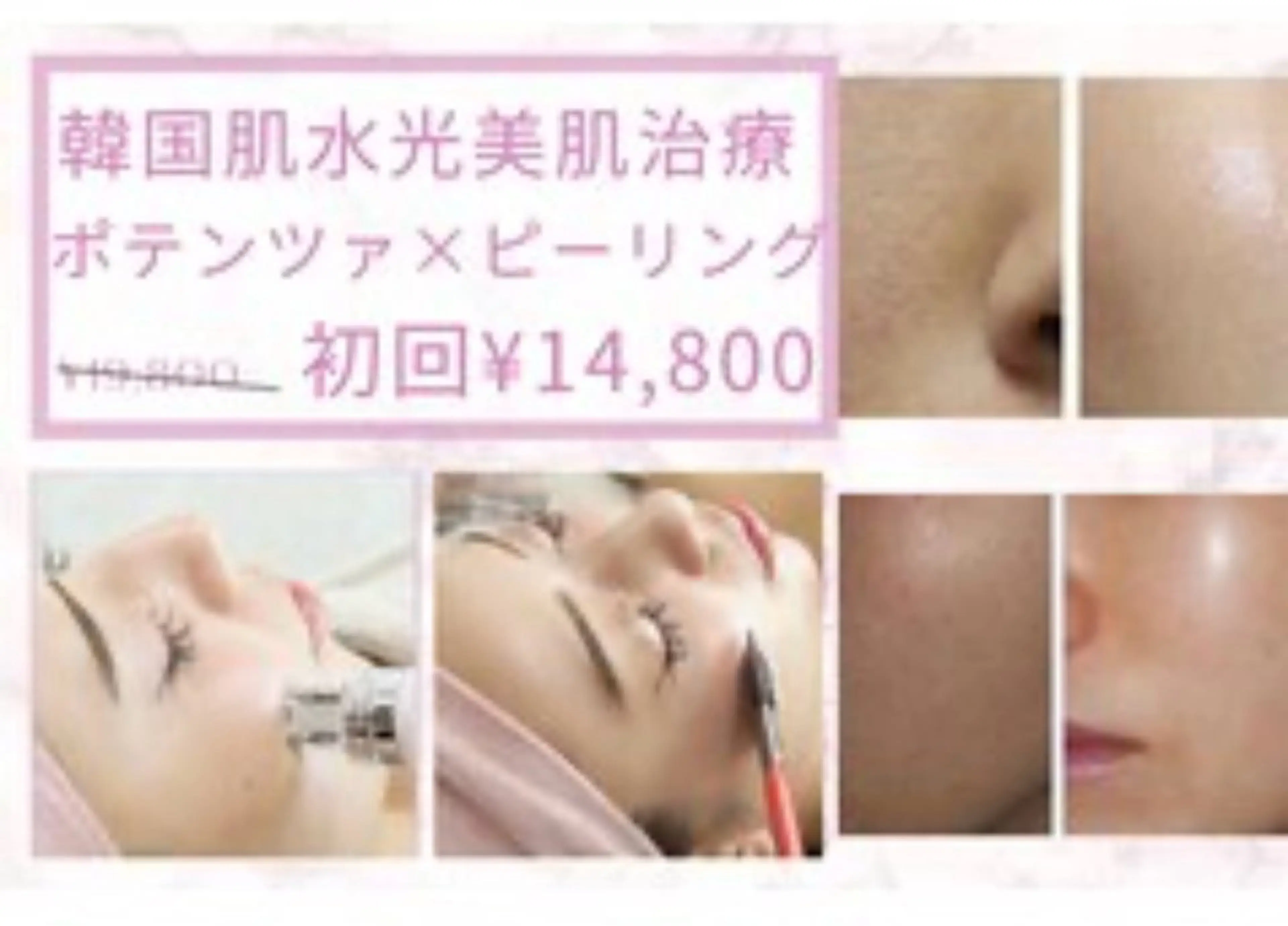 ポテンツァ×ピーリングの写真