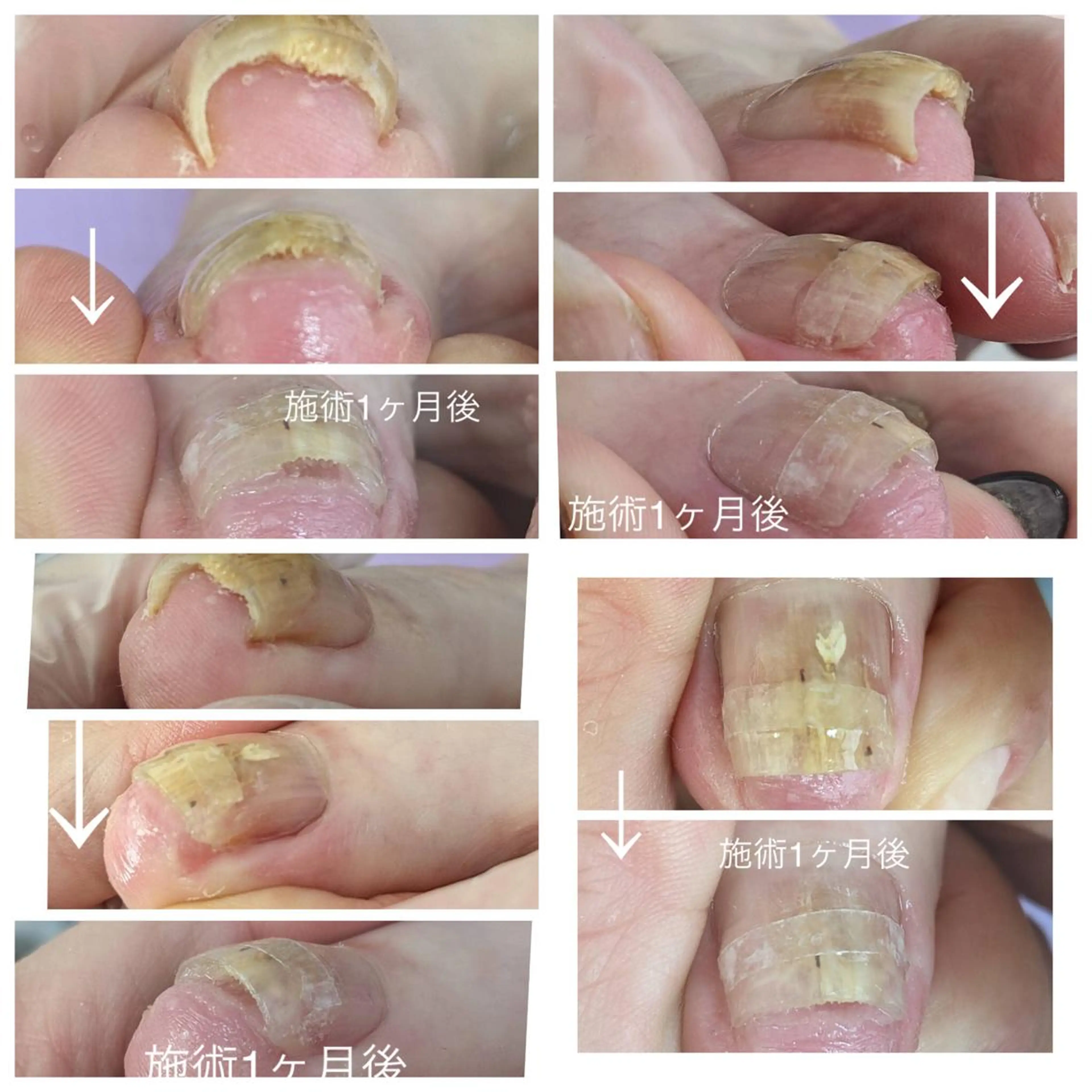 ネイル e.nail所属・和賀井 恵理のネイルデザイン