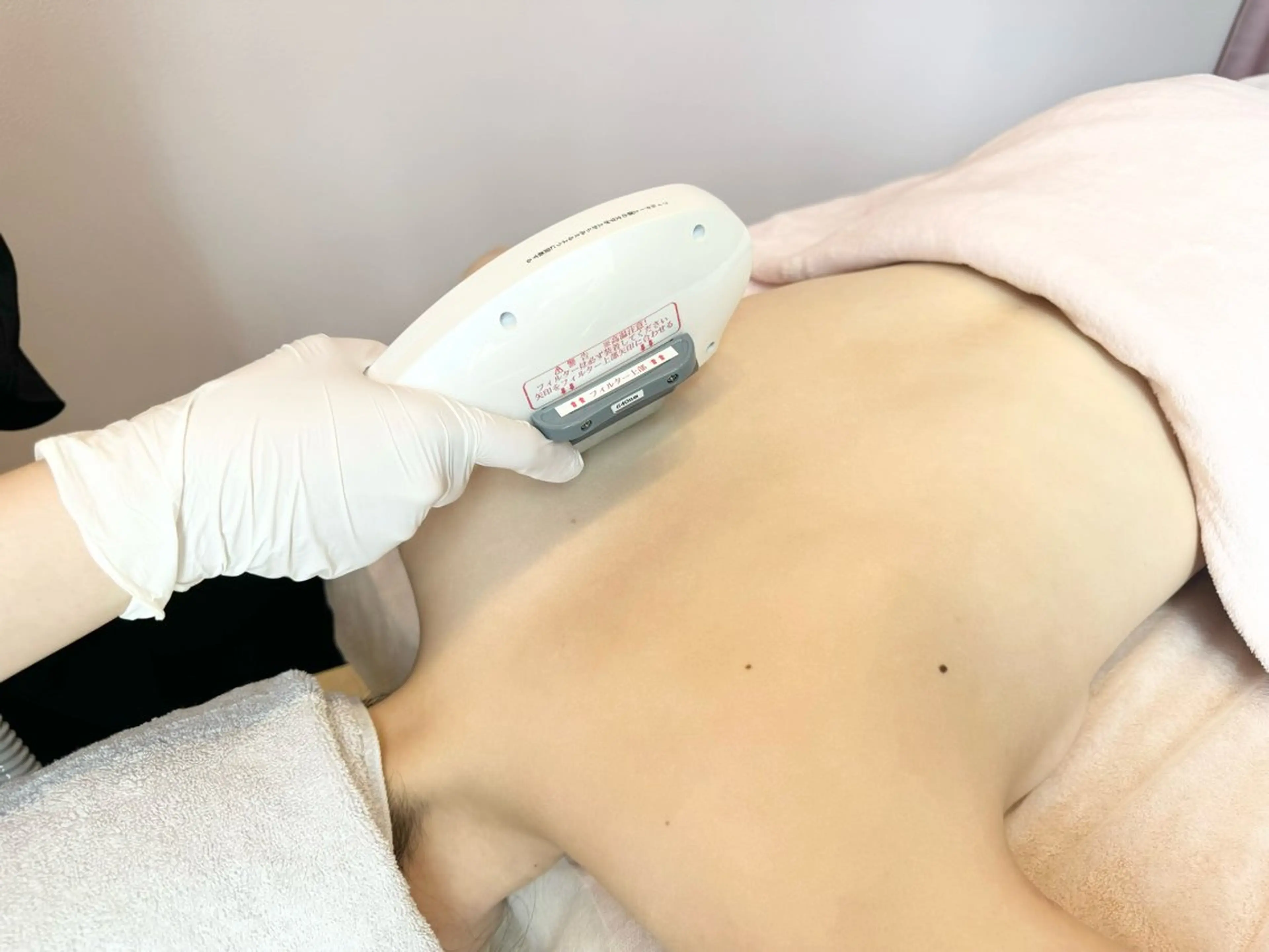 ✨💐【4月限定】ドレスライン（背中・うなじ）脱毛👗✨の写真