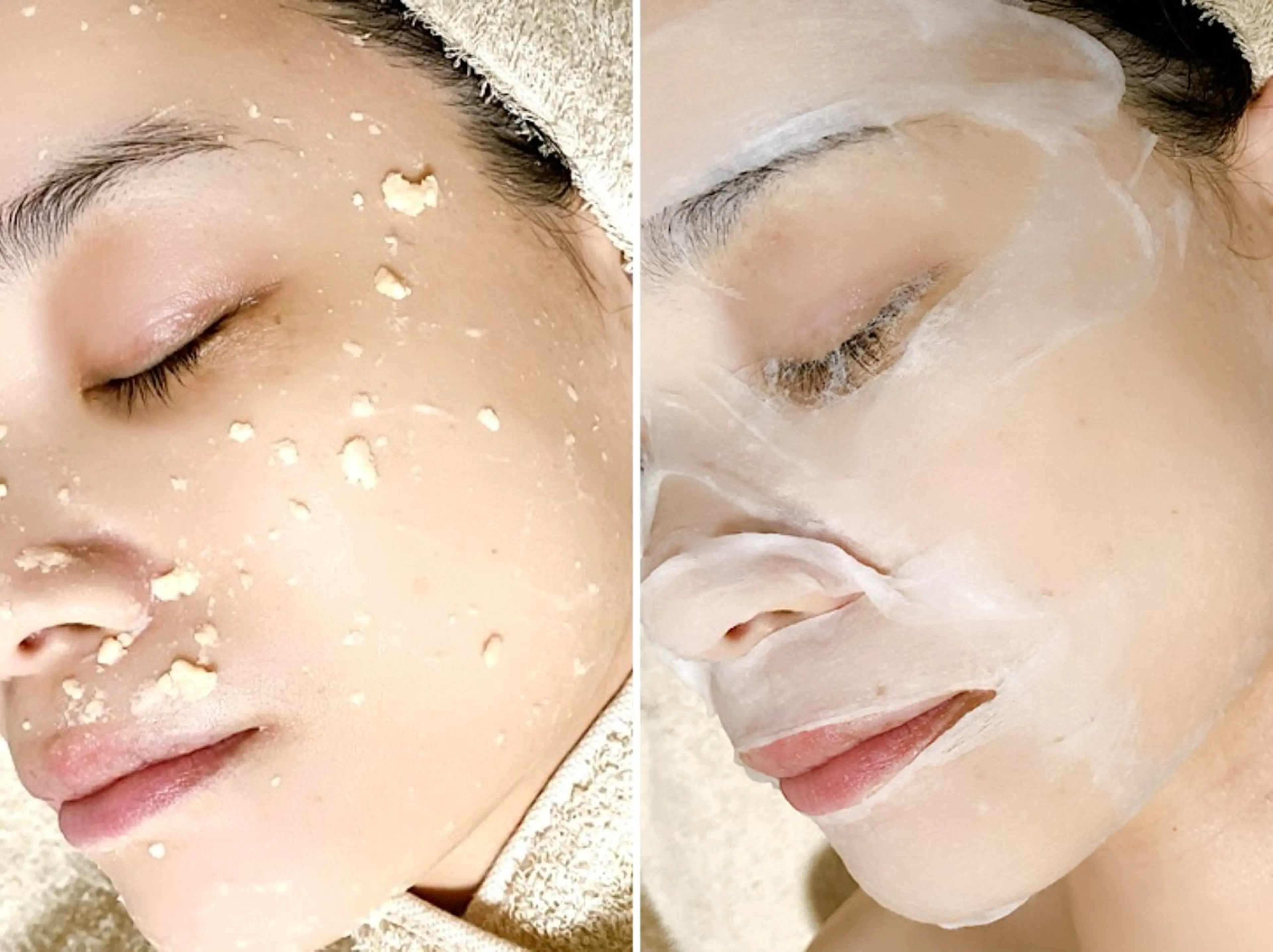 エステ リラク 繰り返すニキビ・毛穴 ✨つくば肌質改善専門のエステ・リラクイメージ