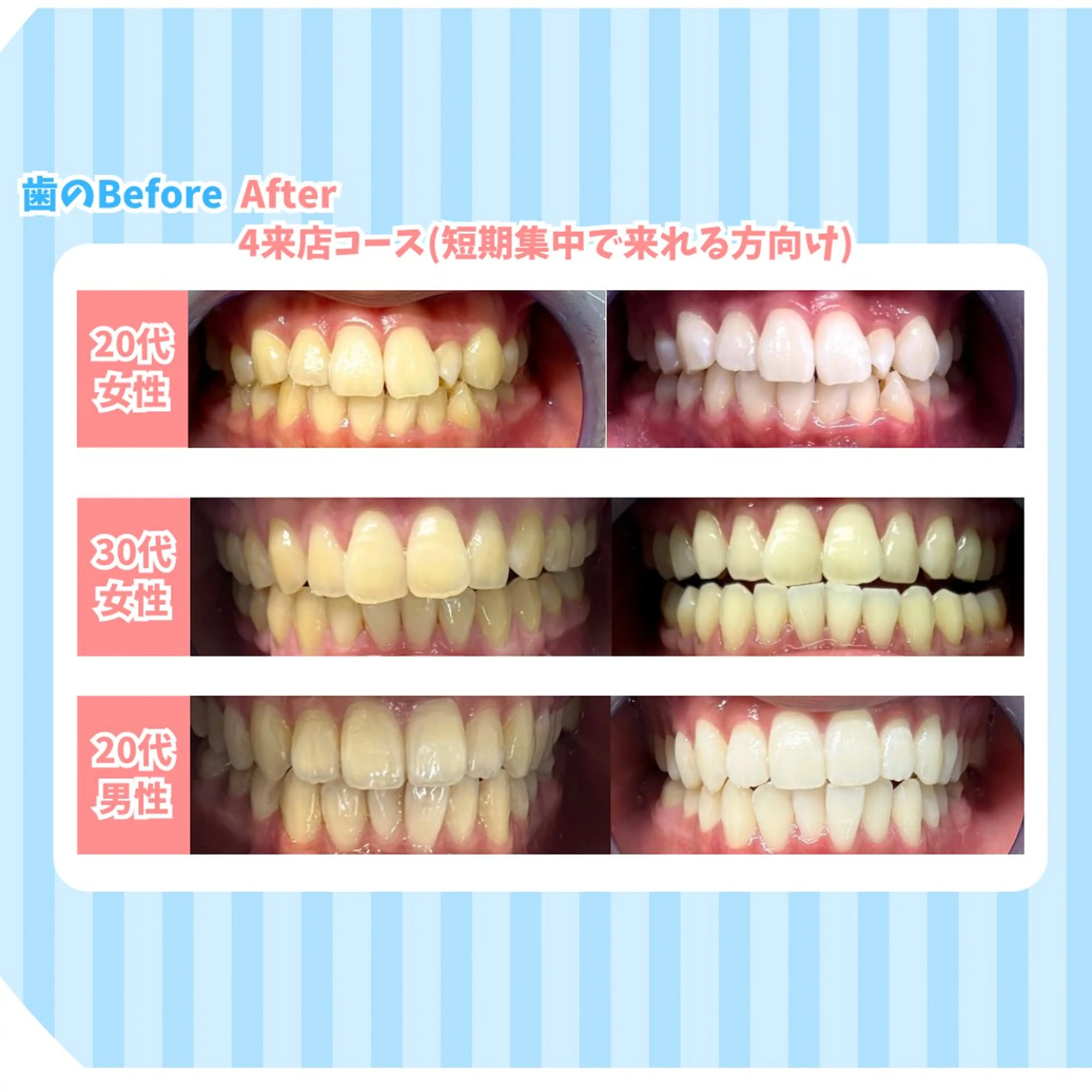 セルフホワイトニング Dolce水戸店のその他イメージ