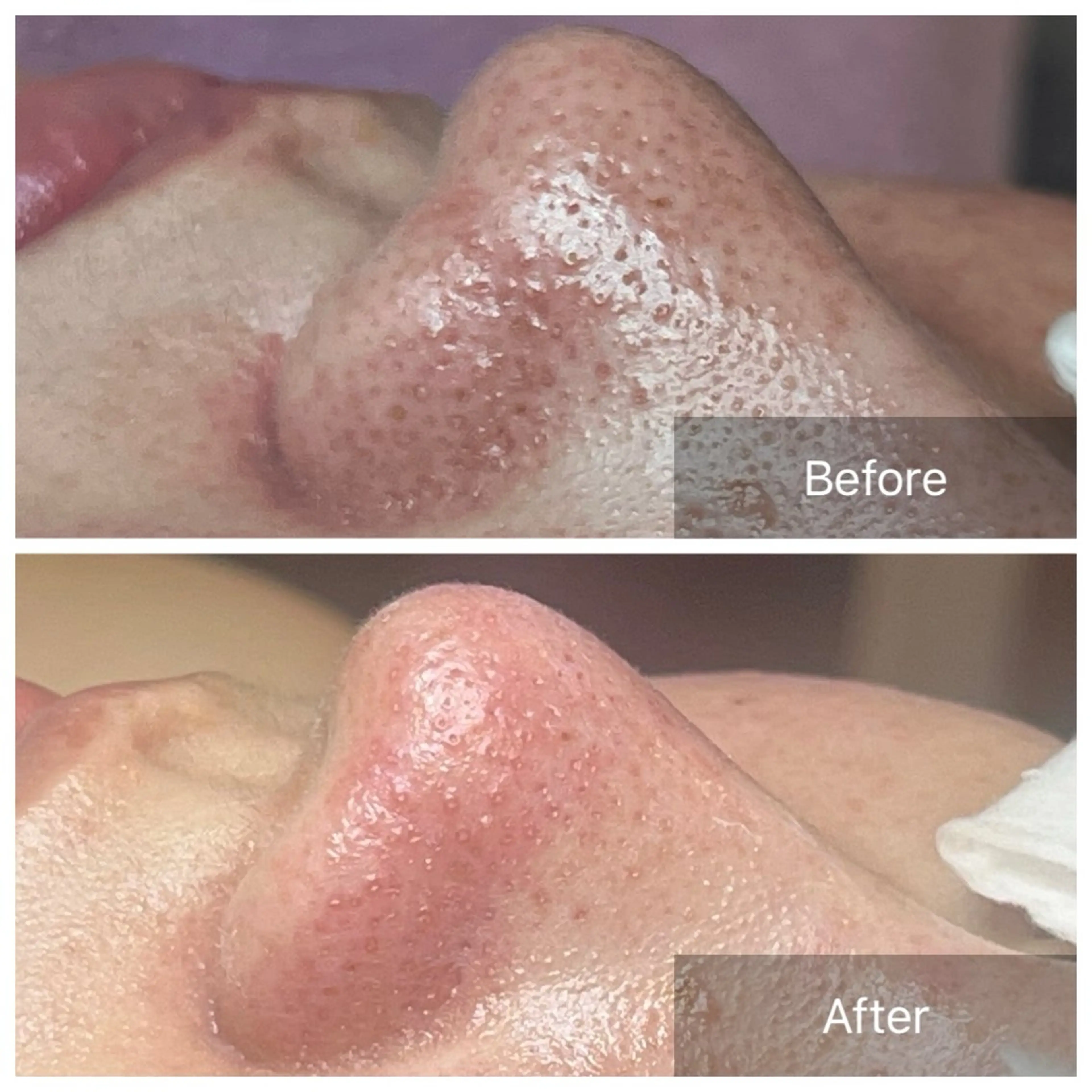 エステ ielu〜毛穴ケア ハーブピーリングのエステ・リラクイメージ