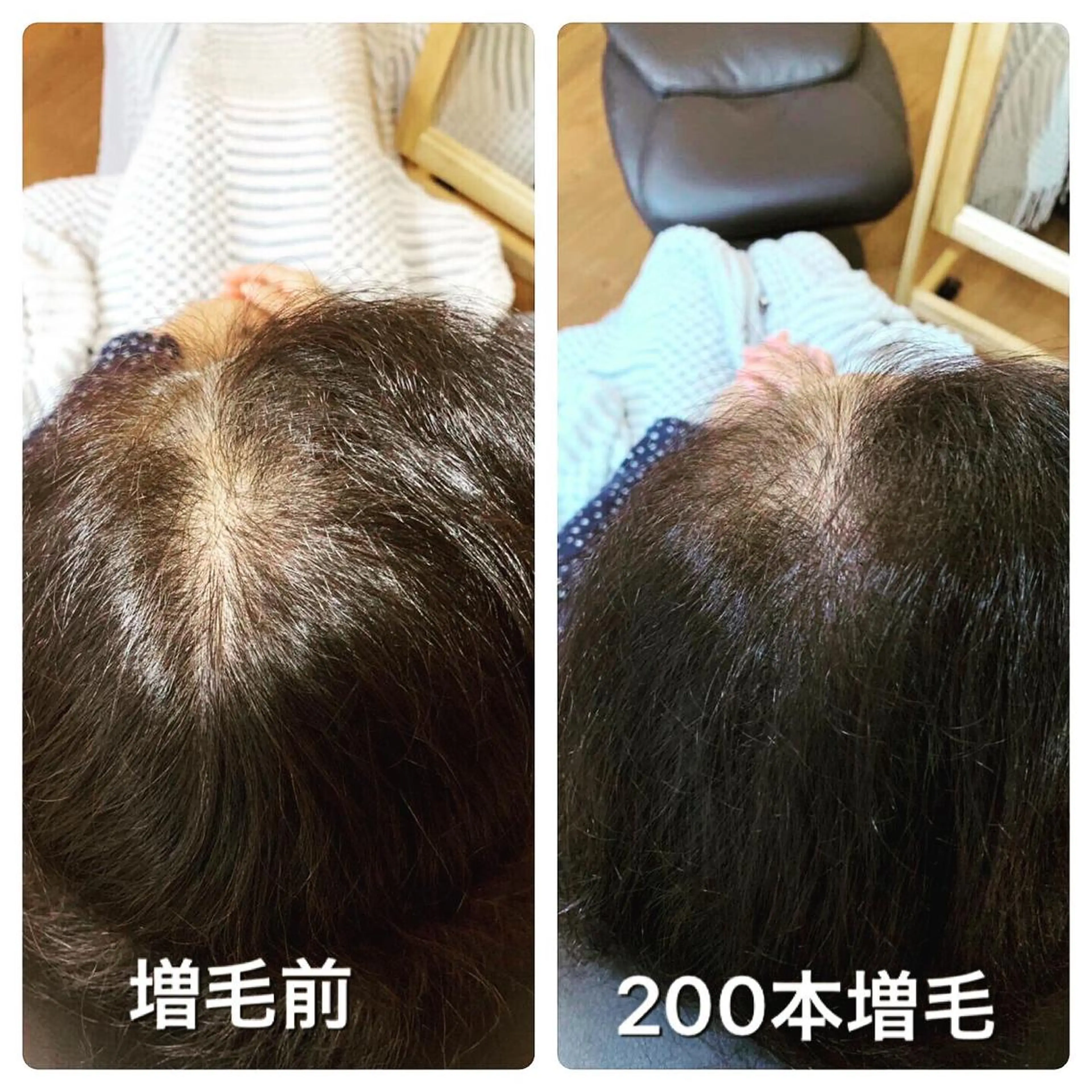 新増毛  エアエク         初回お試し200本の写真