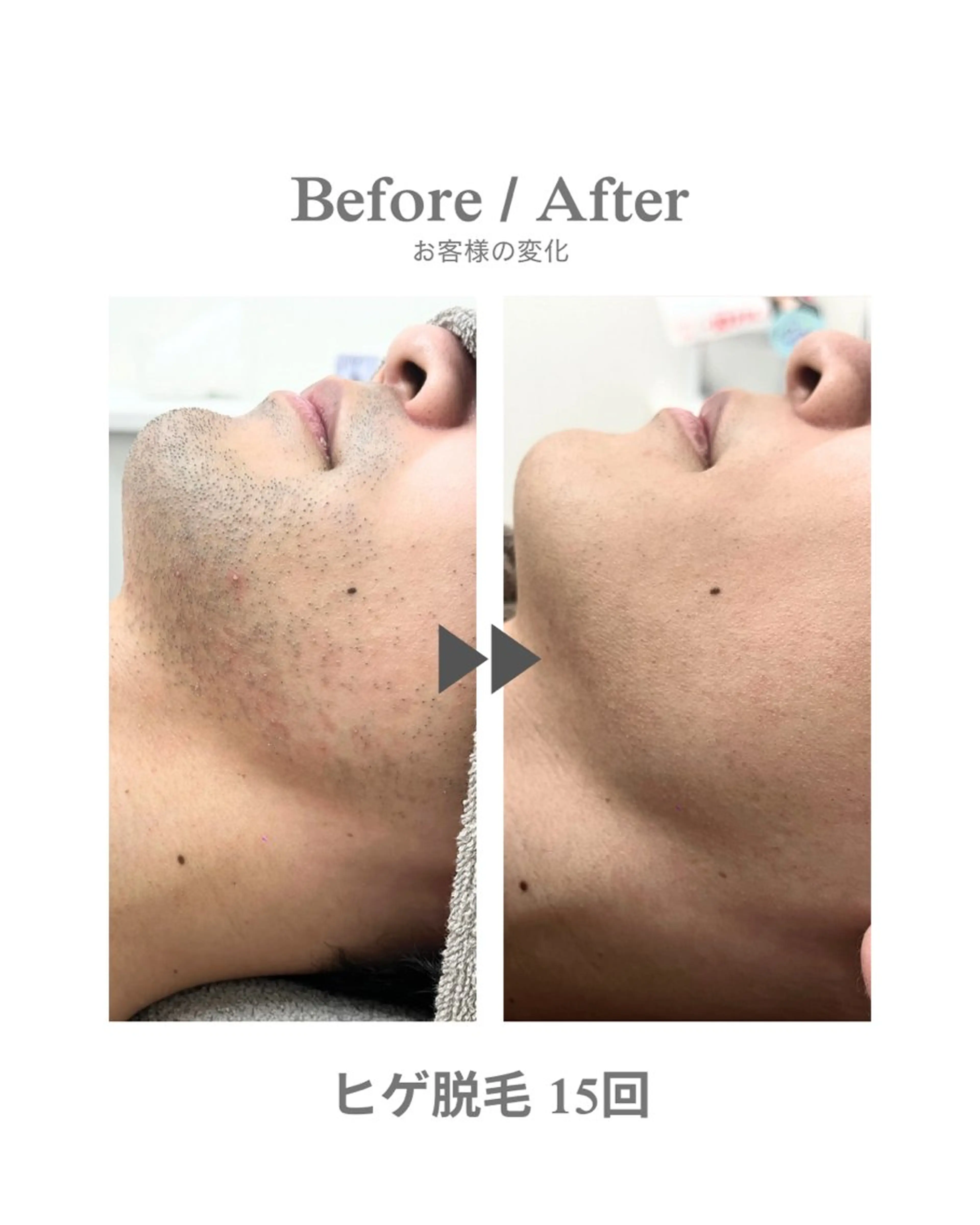 メンズ 脱毛 エステサロンNarcis〜ナルシス〜所属・脱毛＆痩身エステ Narcisのエステ・リラクイメージ