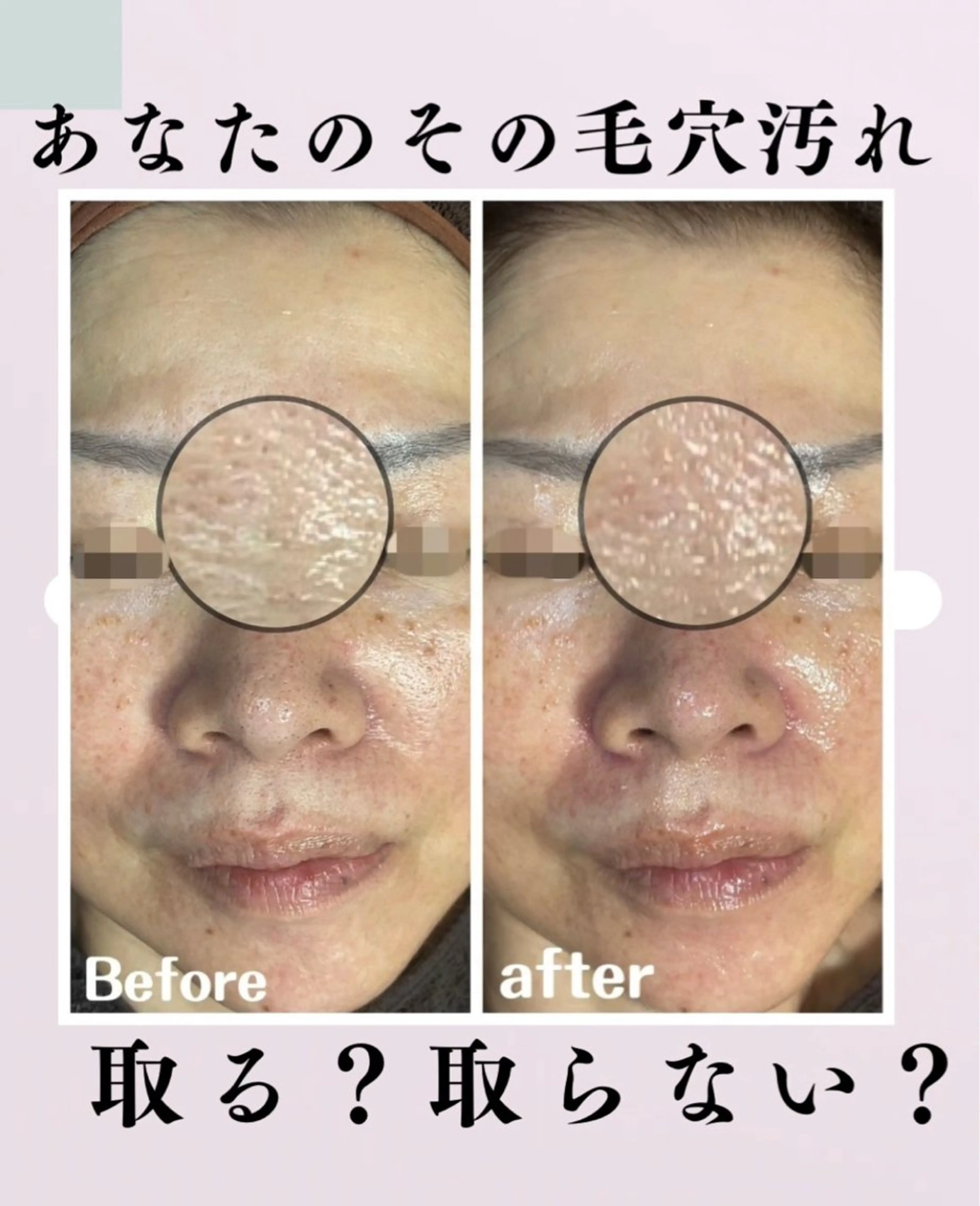 肌質改善サロン facialmoonのエステ・リラクイメージ