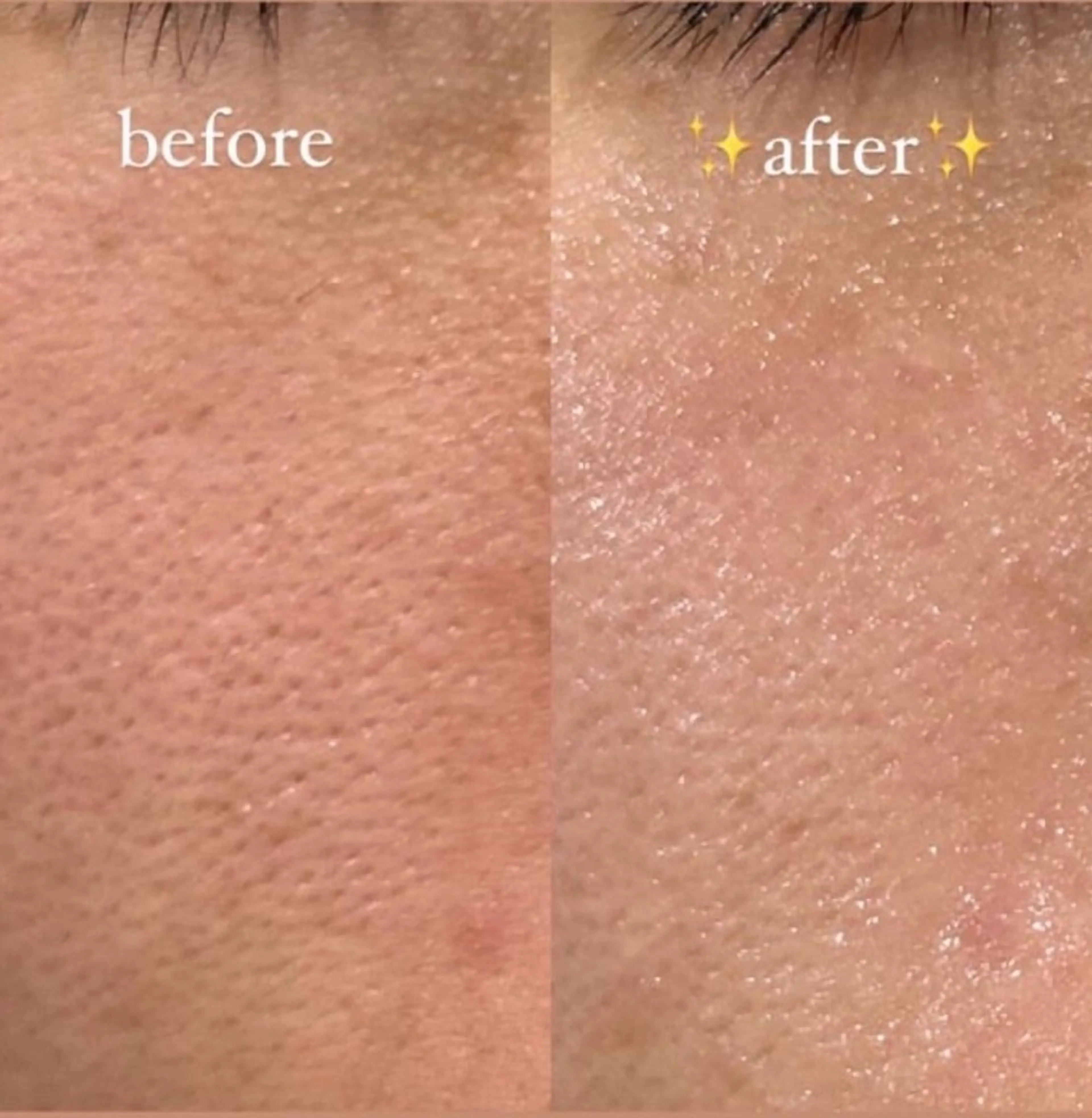 エステ 肌質改善専門 ハーブ /毛穴洗浄 リエイトのエステ・リラクイメージ