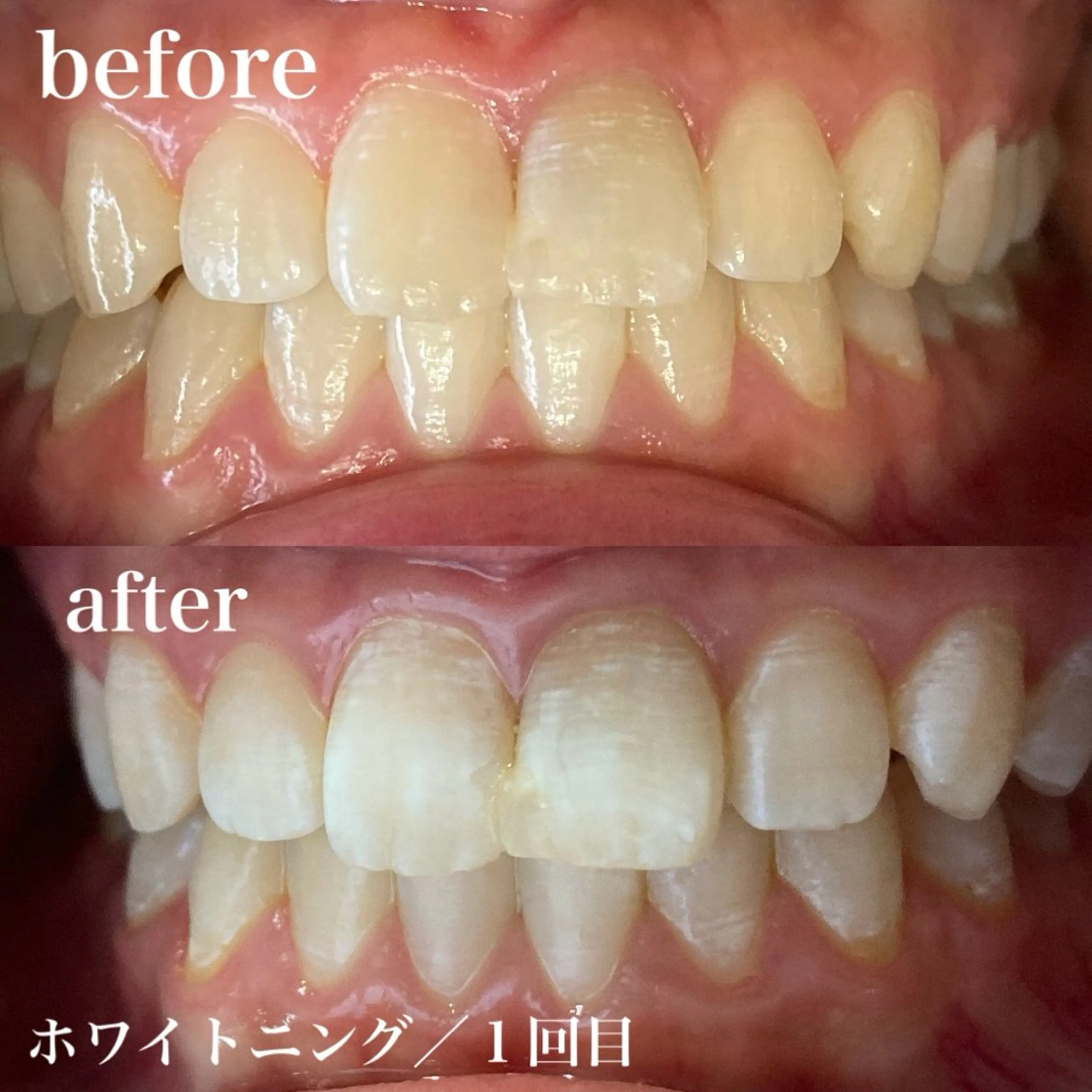 磐田｜LAYLA 一番丁寧な脱毛店のエステ・リラクイメージ