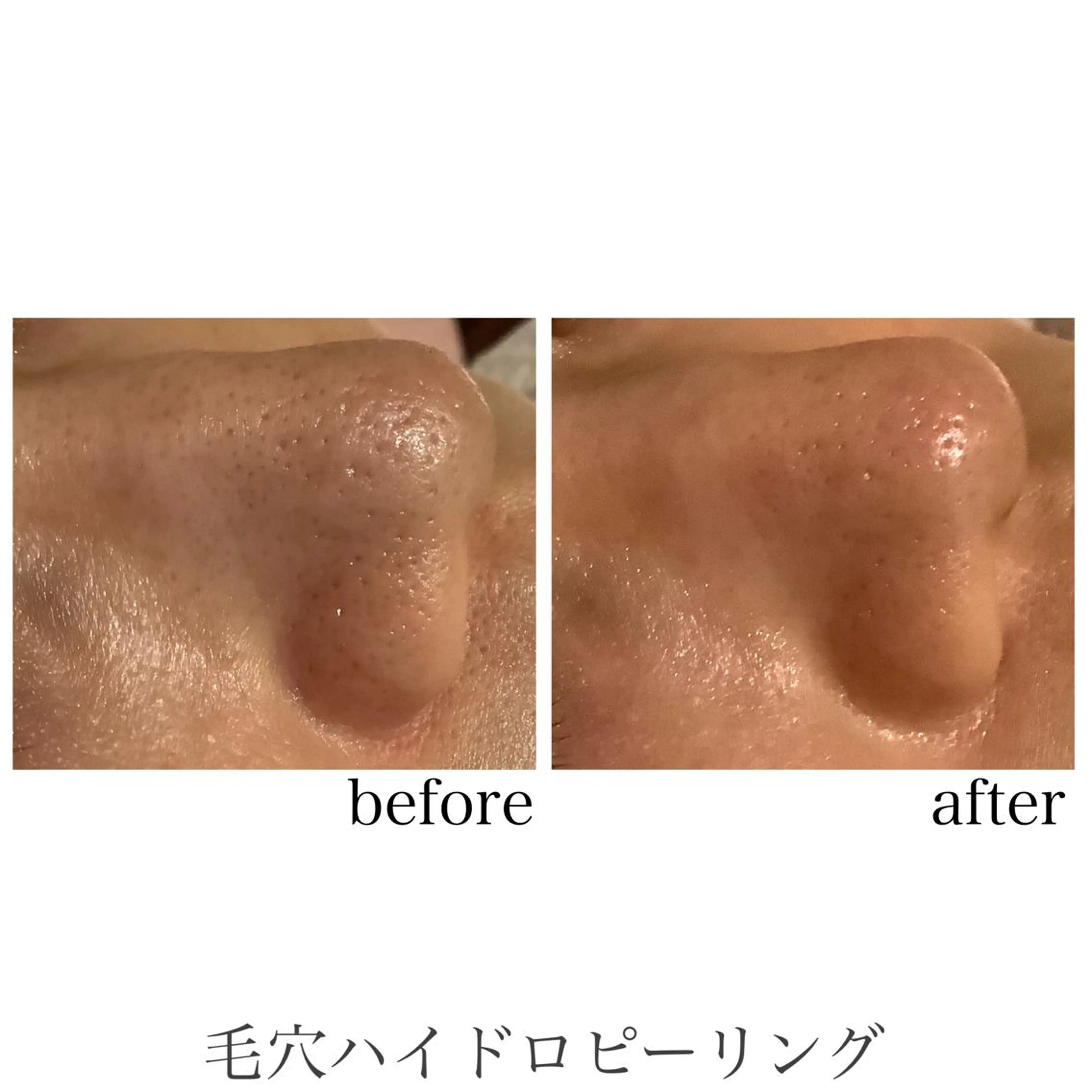 脱毛&エステサロン JIGGLY武蔵小山のエステ・リラクイメージ