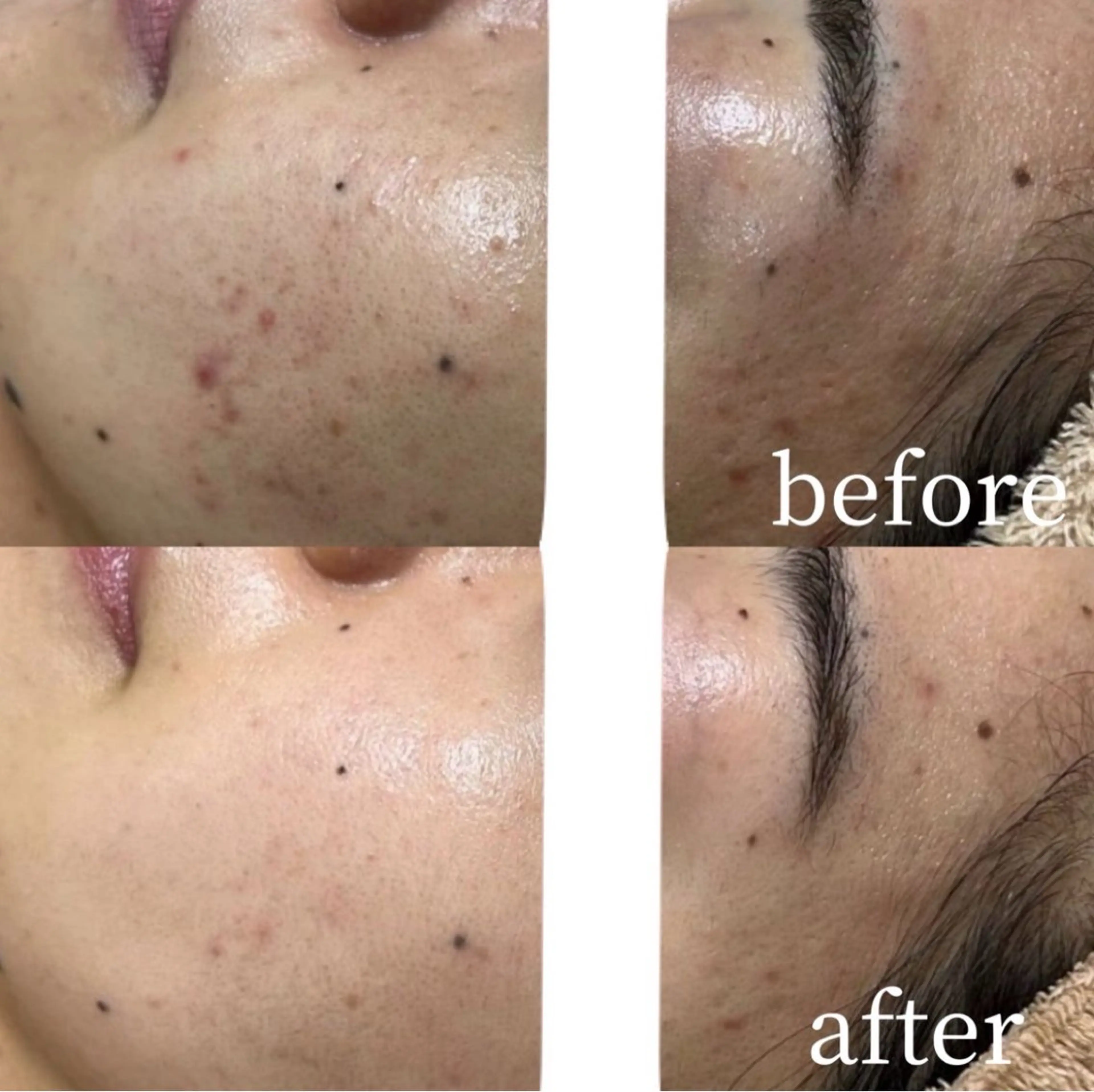 エステ aimer 島田のエステ・リラクイメージ