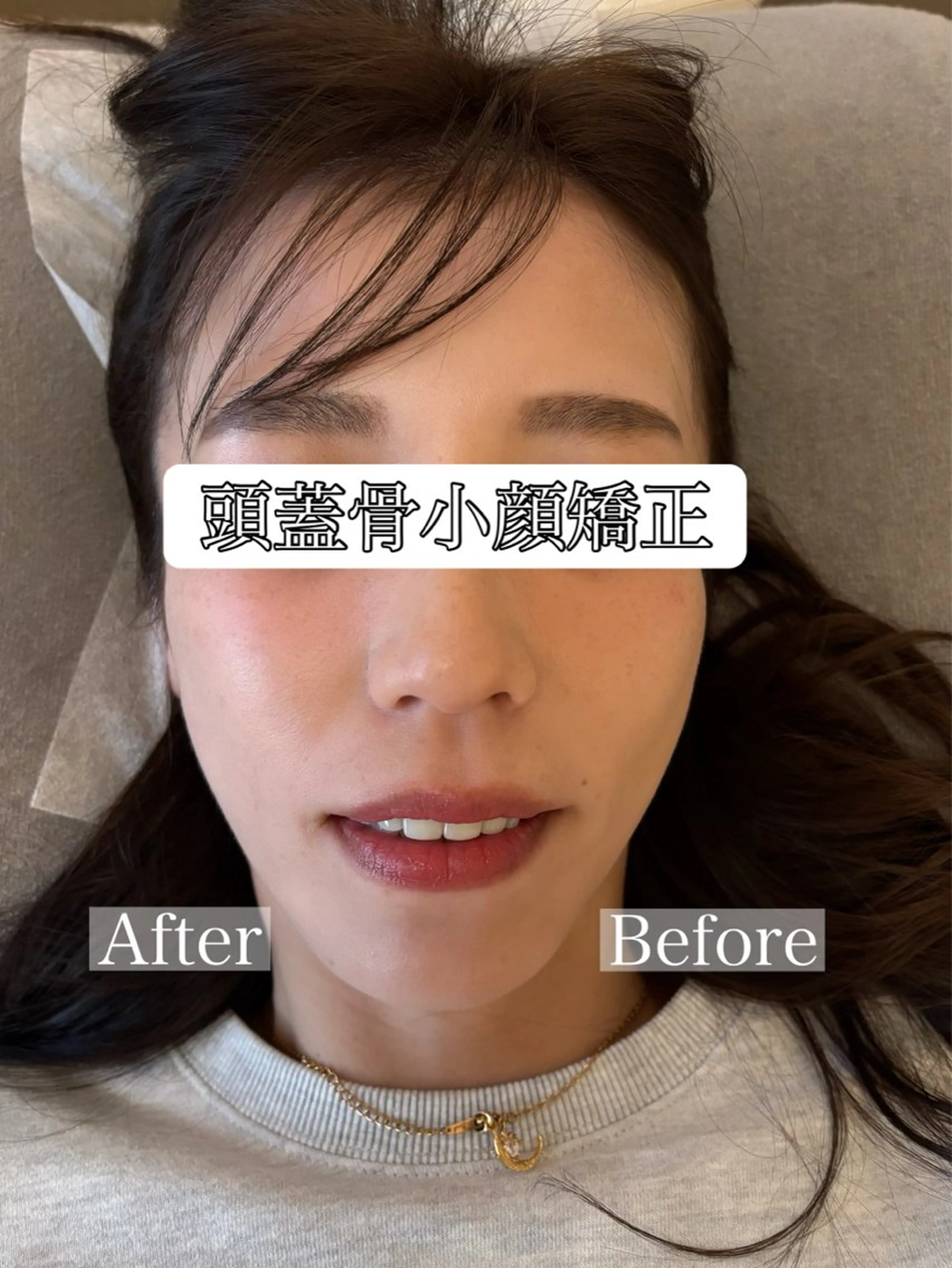 リラク Top Face立川 【小顔矯正】小川のエステ・リラクイメージ