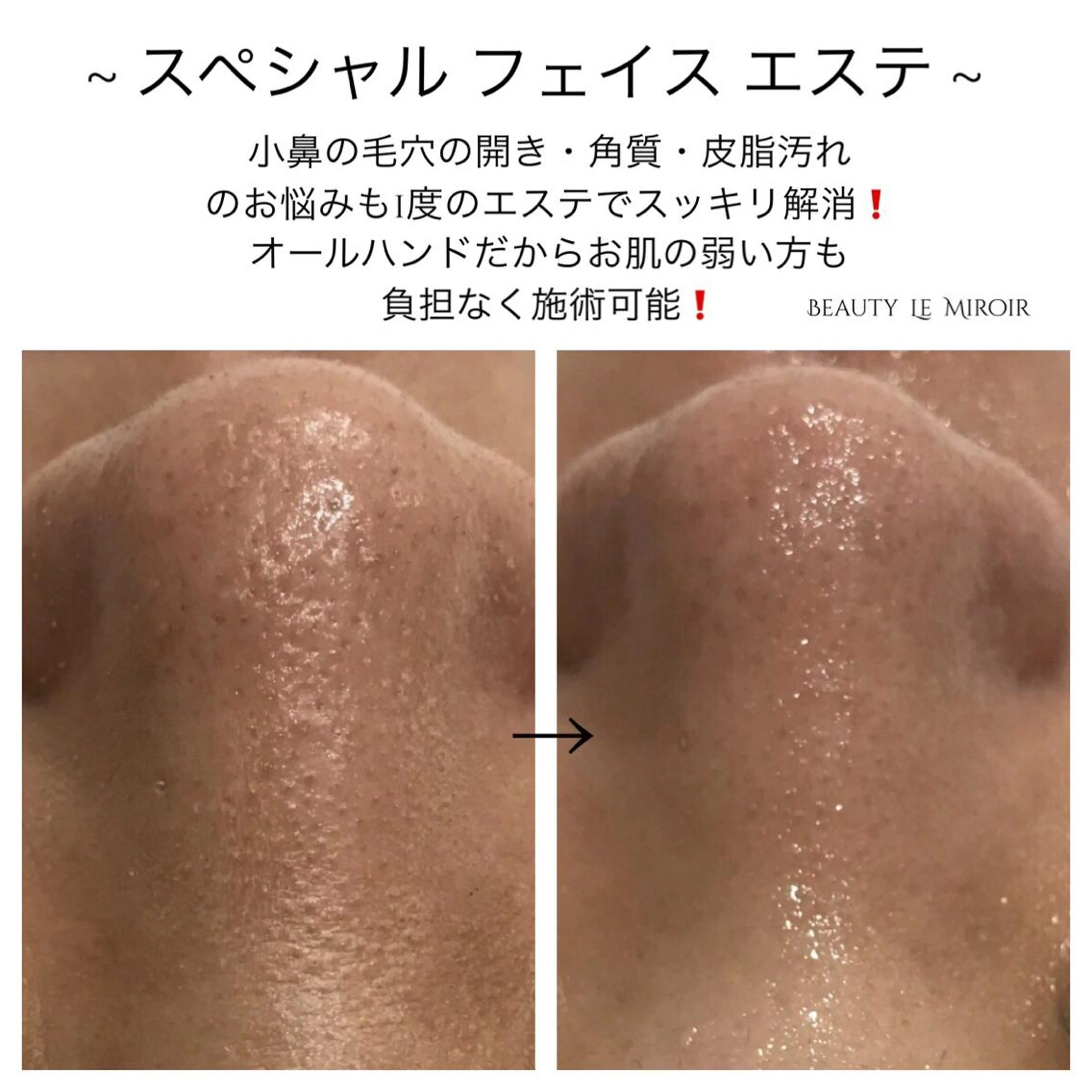 ビューティー ミロワールのエステ・リラクイメージ