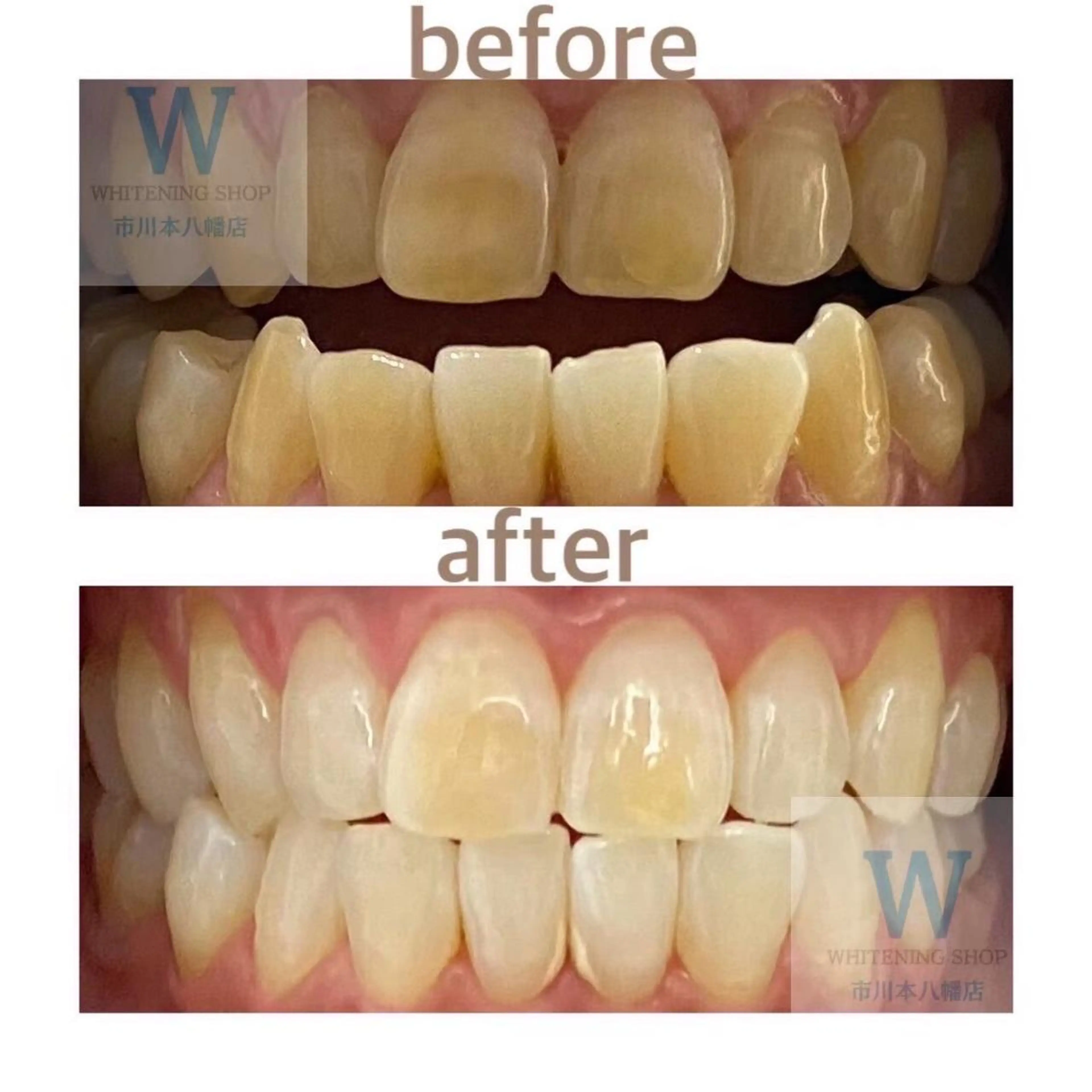 ホワイトニング ショップ本八幡店のエステ・リラクイメージ