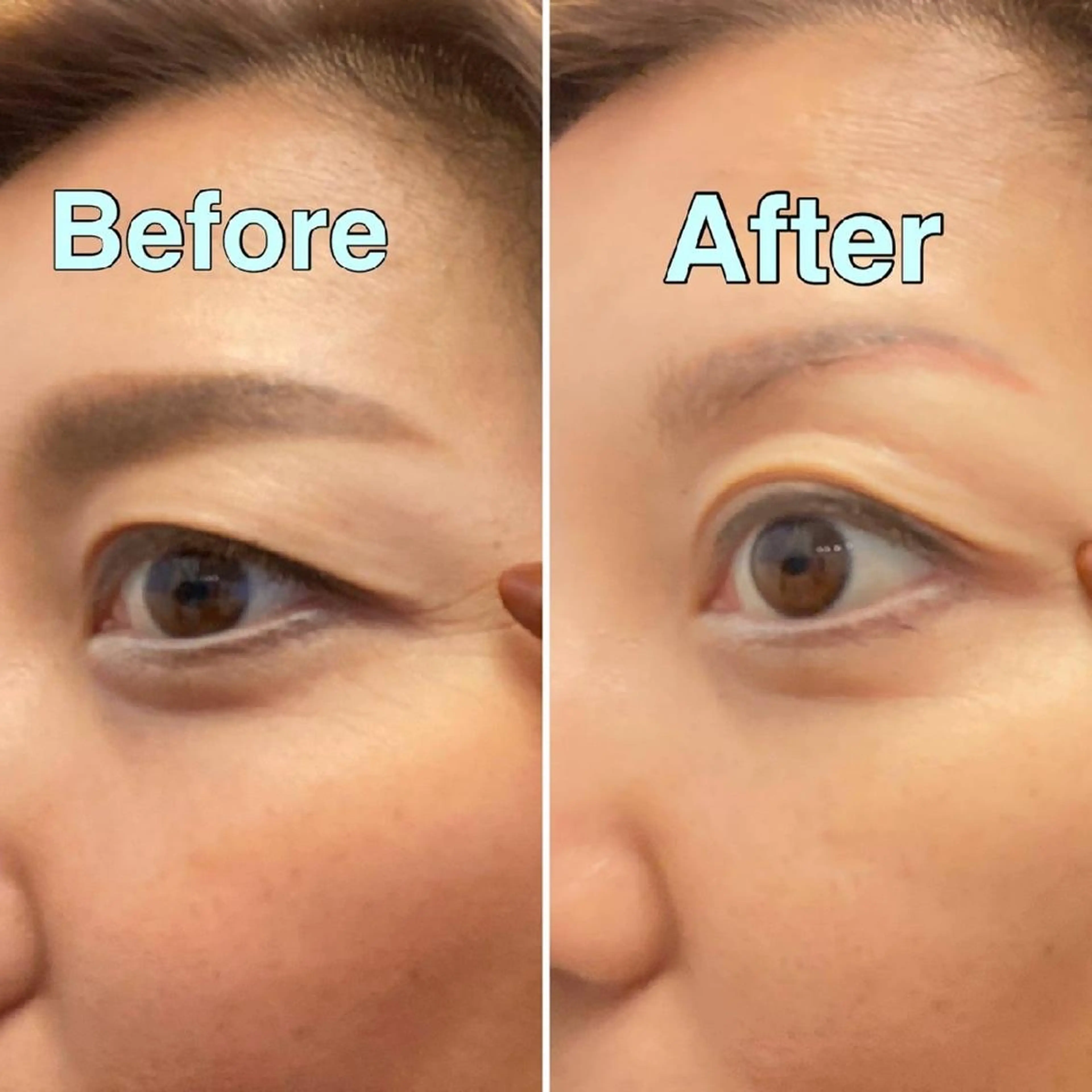 Mecal RYOKOのその他イメージ