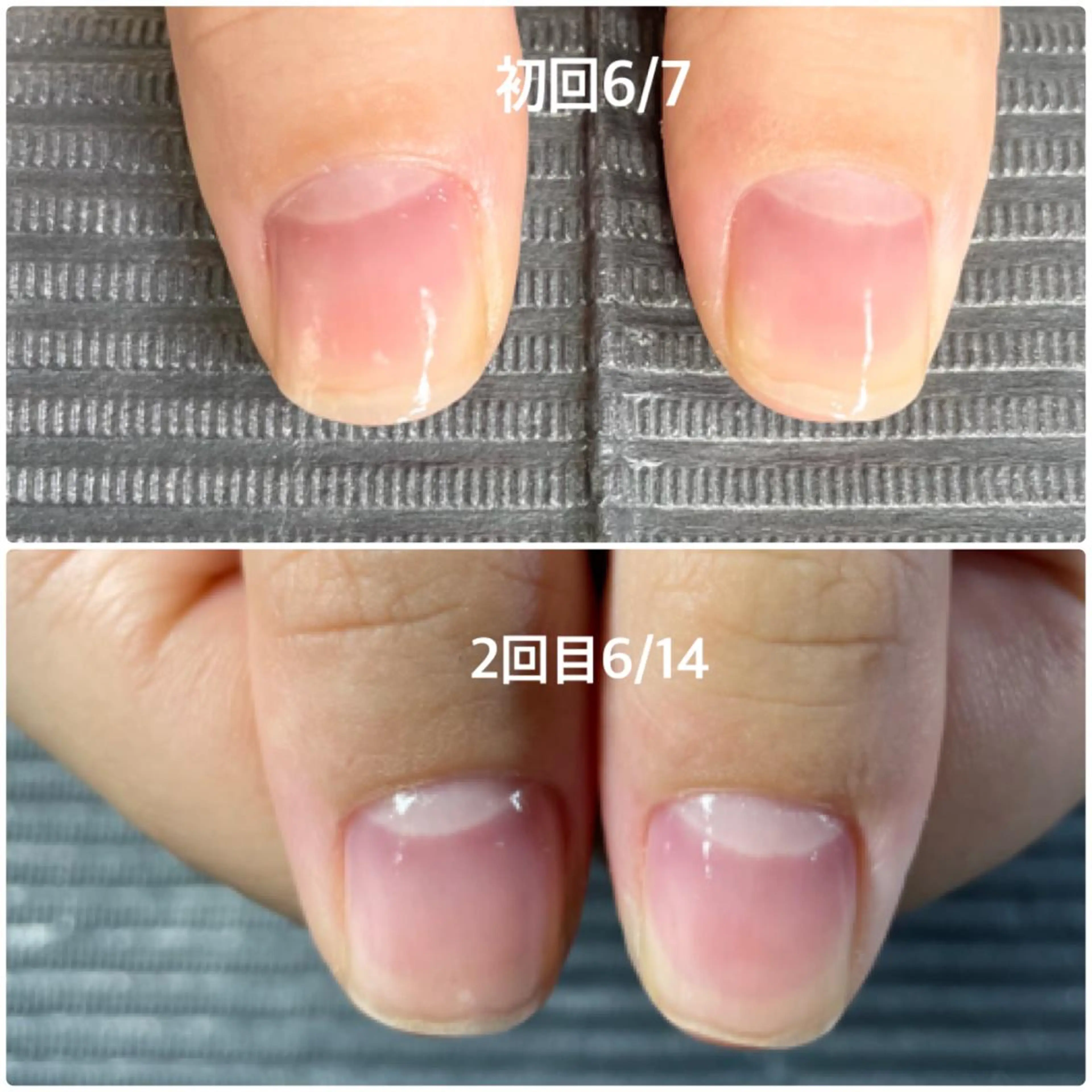 ネイル 奥園 良恵のネイルデザイン