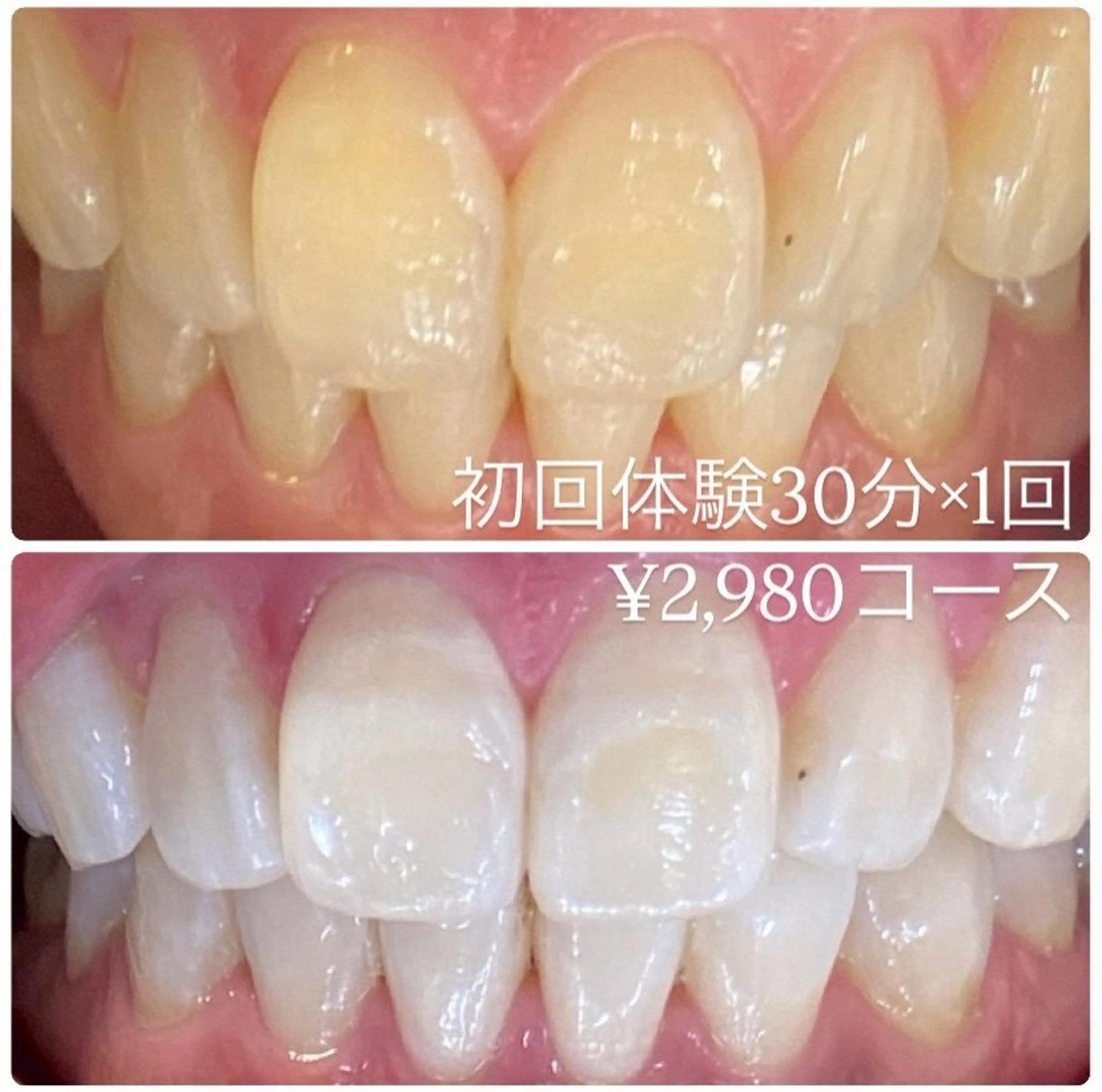 メンズ その他 ホワイトニング ルーム　川崎店のその他イメージ