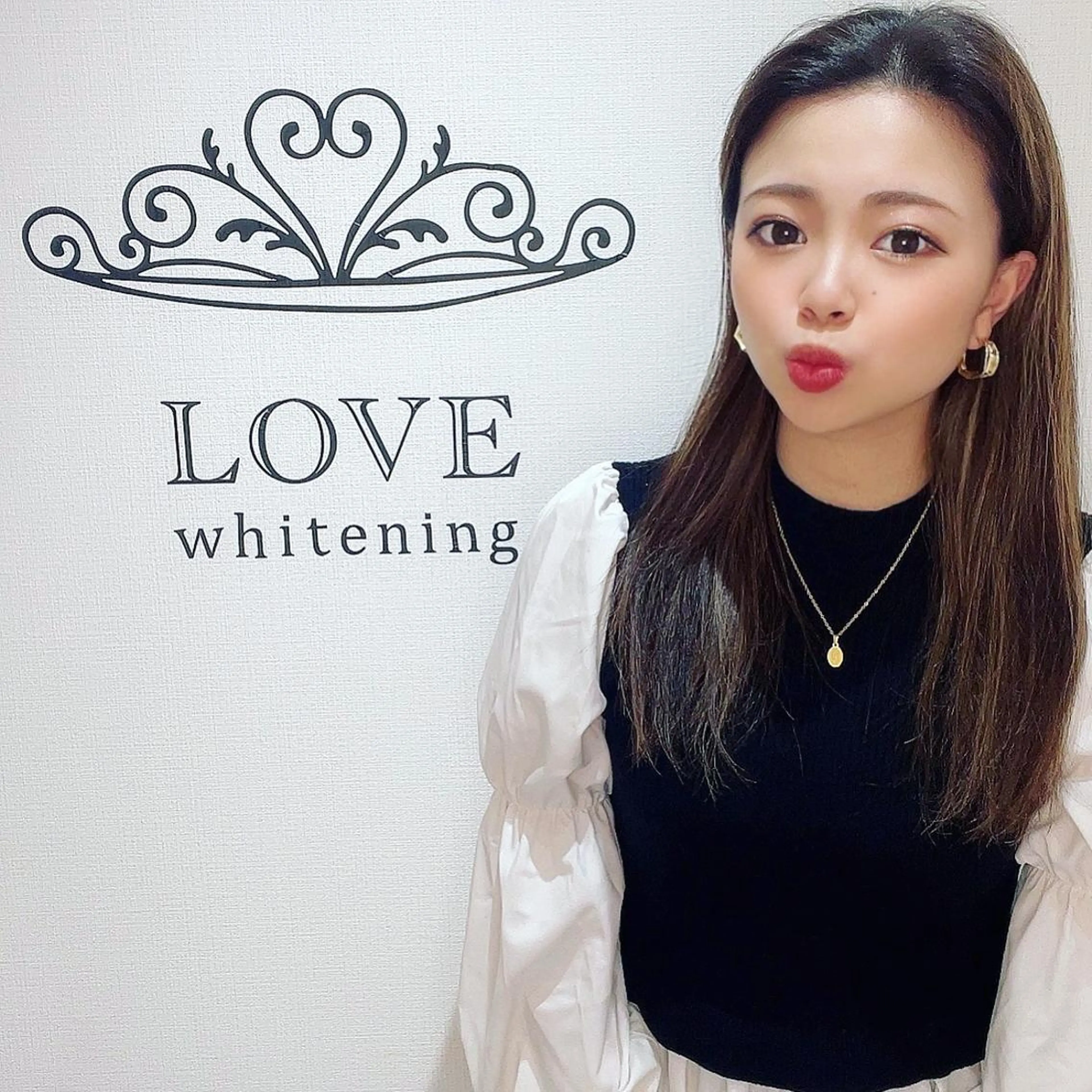 その他 LOVE ホワイトニング戸辺のその他イメージ