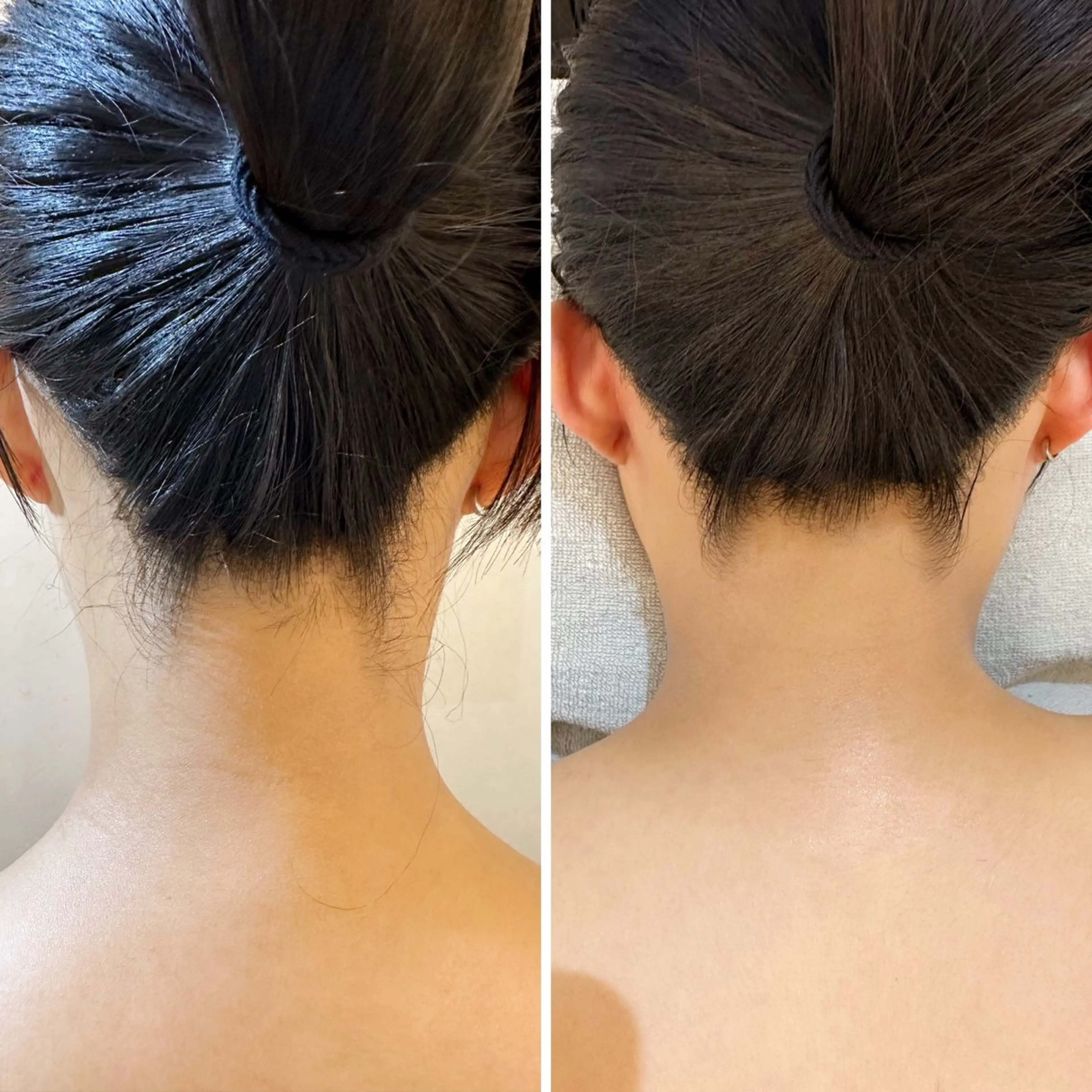 脱毛 うなじ脱毛/美肌脱毛 LABELのエステ・リラクイメージ