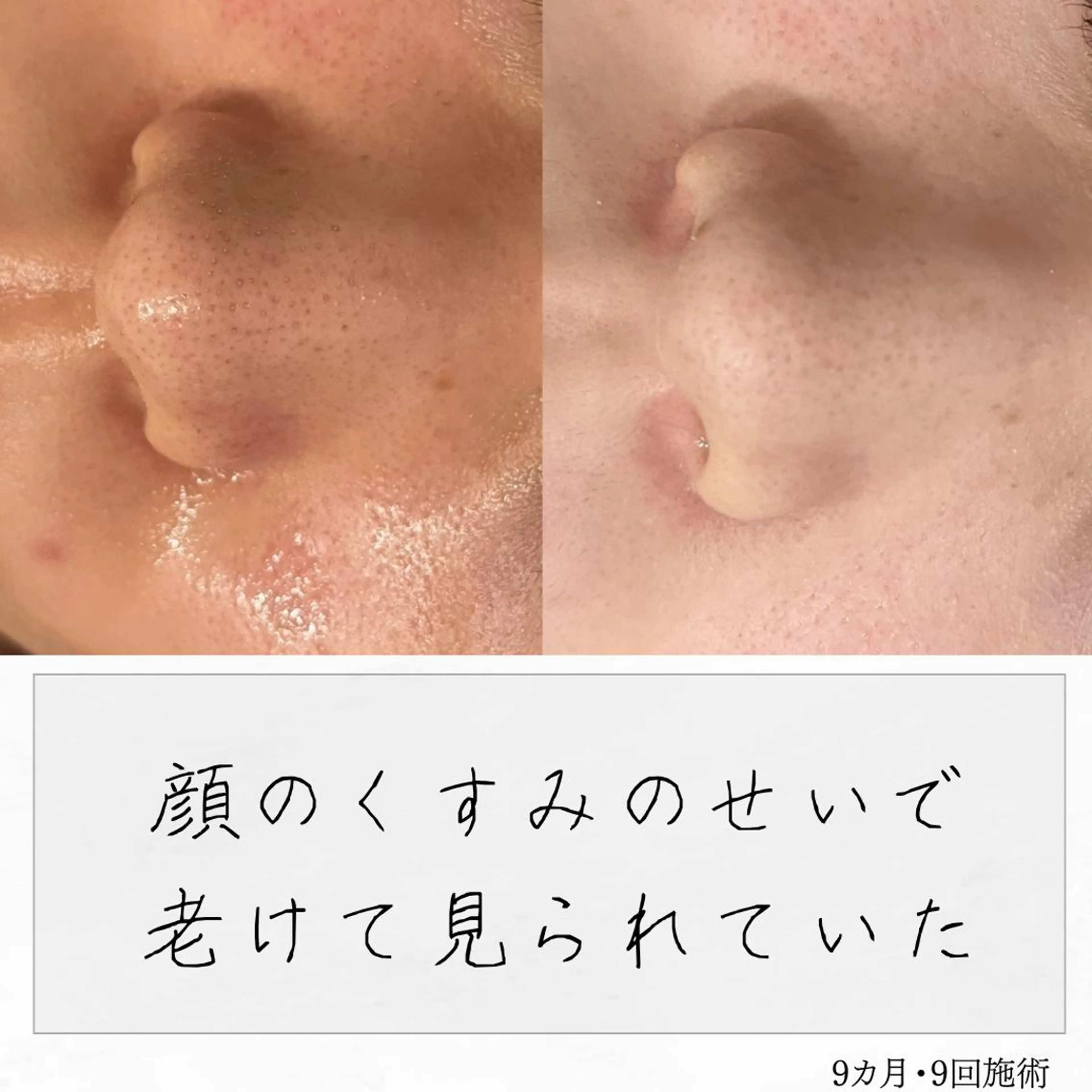 ニキビ経験者が施術 する専門サロン🌻のエステ・リラクイメージ