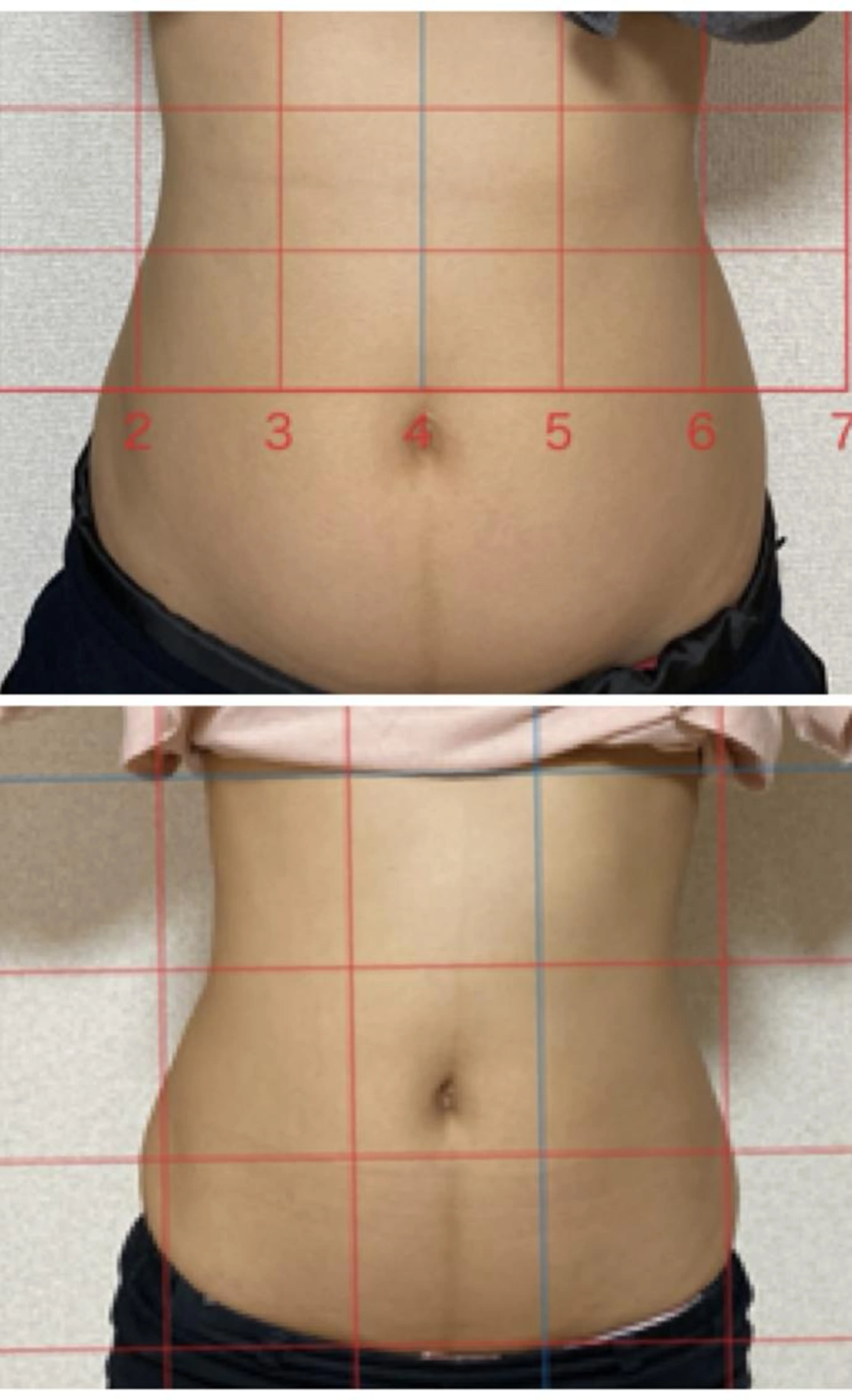 1ヶ月通い放題❣️国内最大パワーで30分スリム革命効果大‼︎の写真