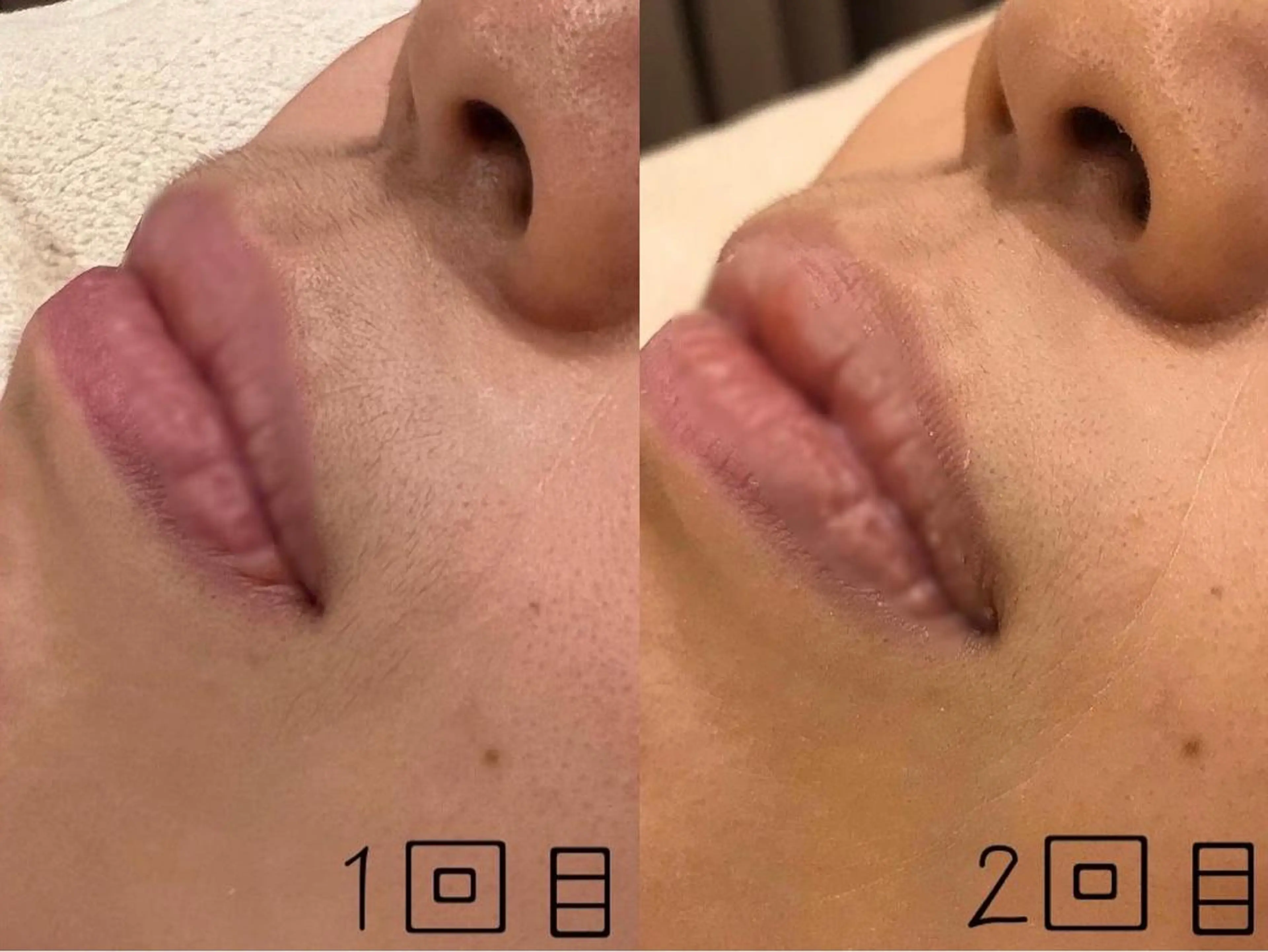 脱毛 ULULU 上野店のエステ・リラクイメージ