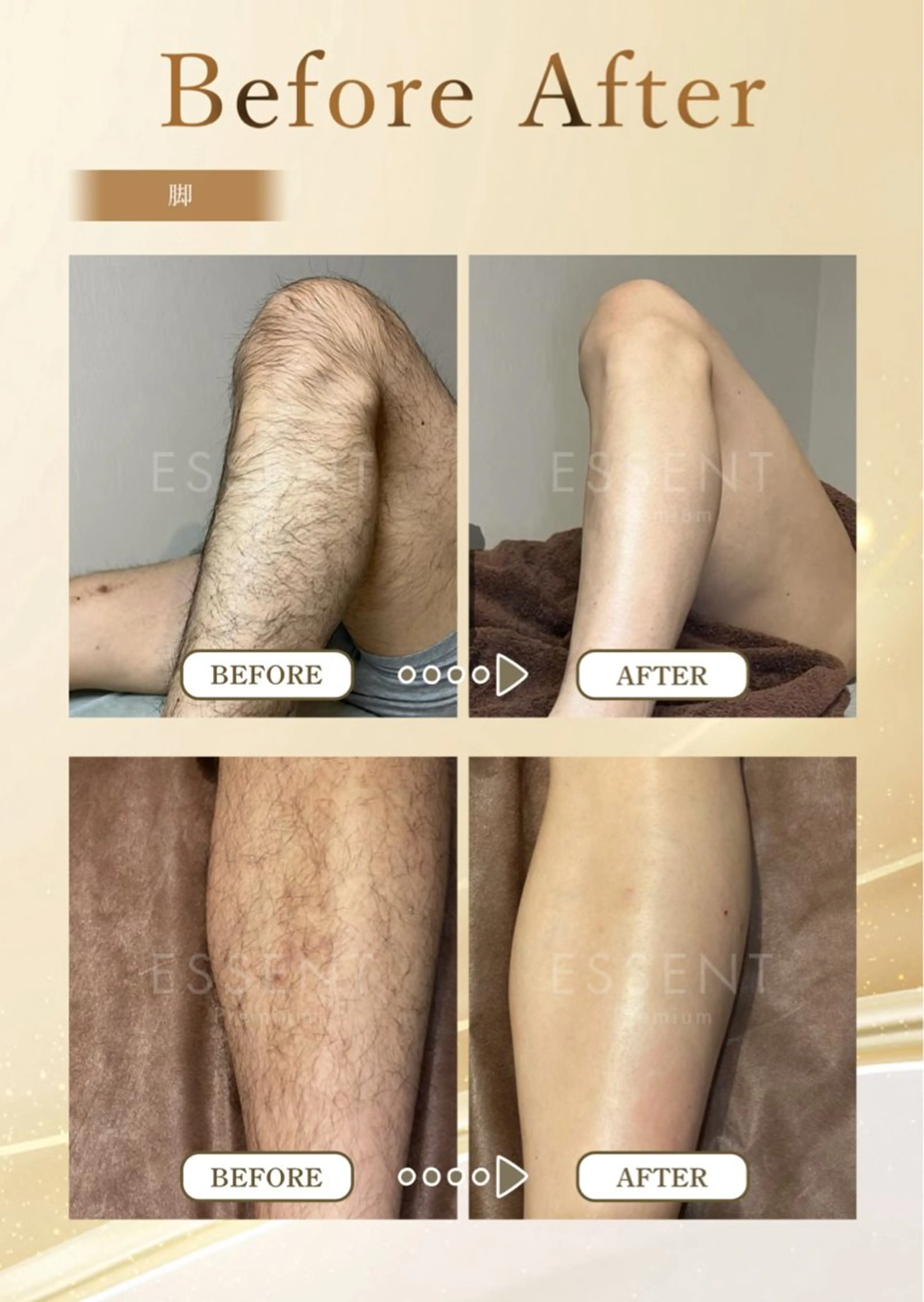 脱毛 sealily ㅡnail・脱毛ㅡのエステ・リラクイメージ