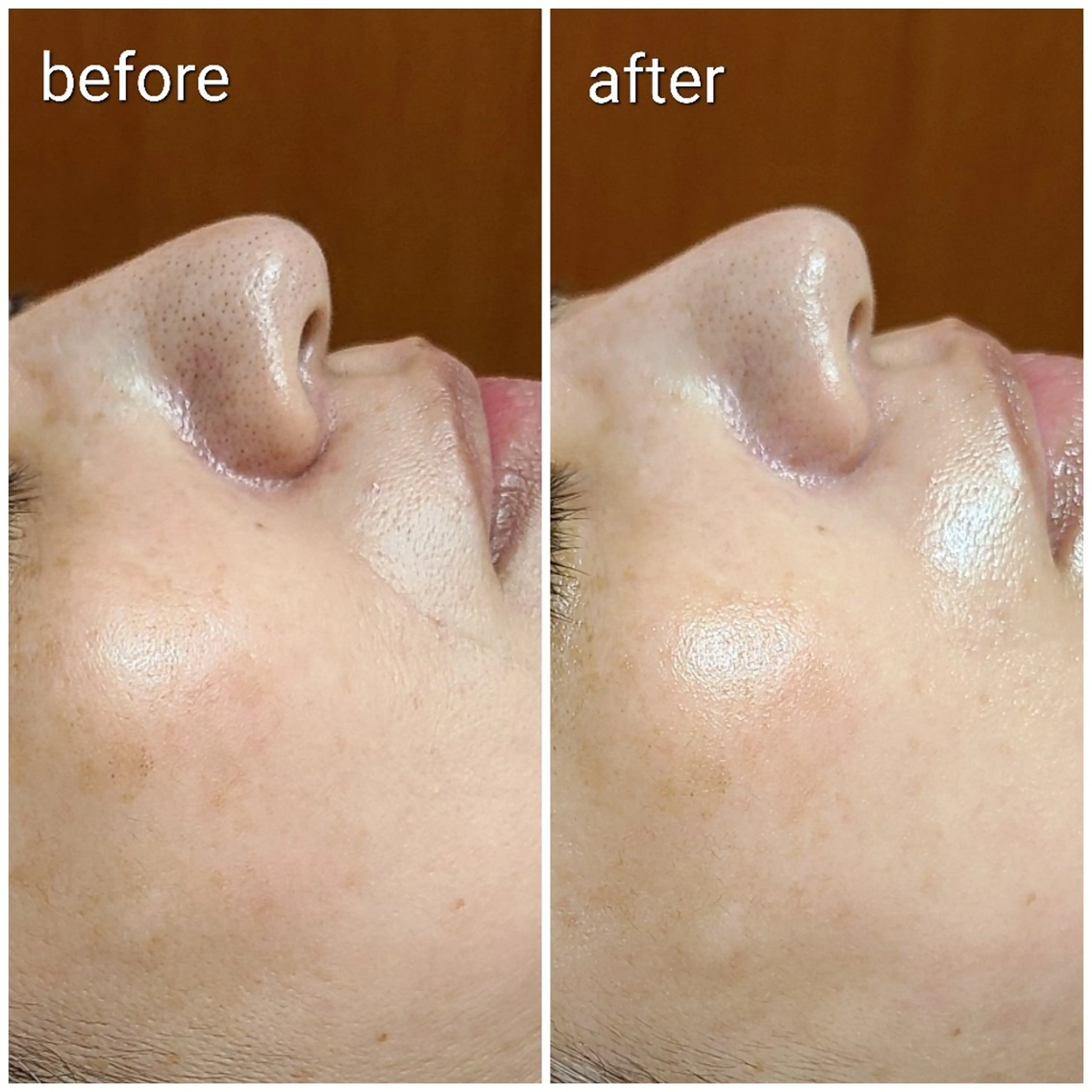 エステ 顔ツボ整顔セラピスト 三根百恵のエステ・リラクイメージ