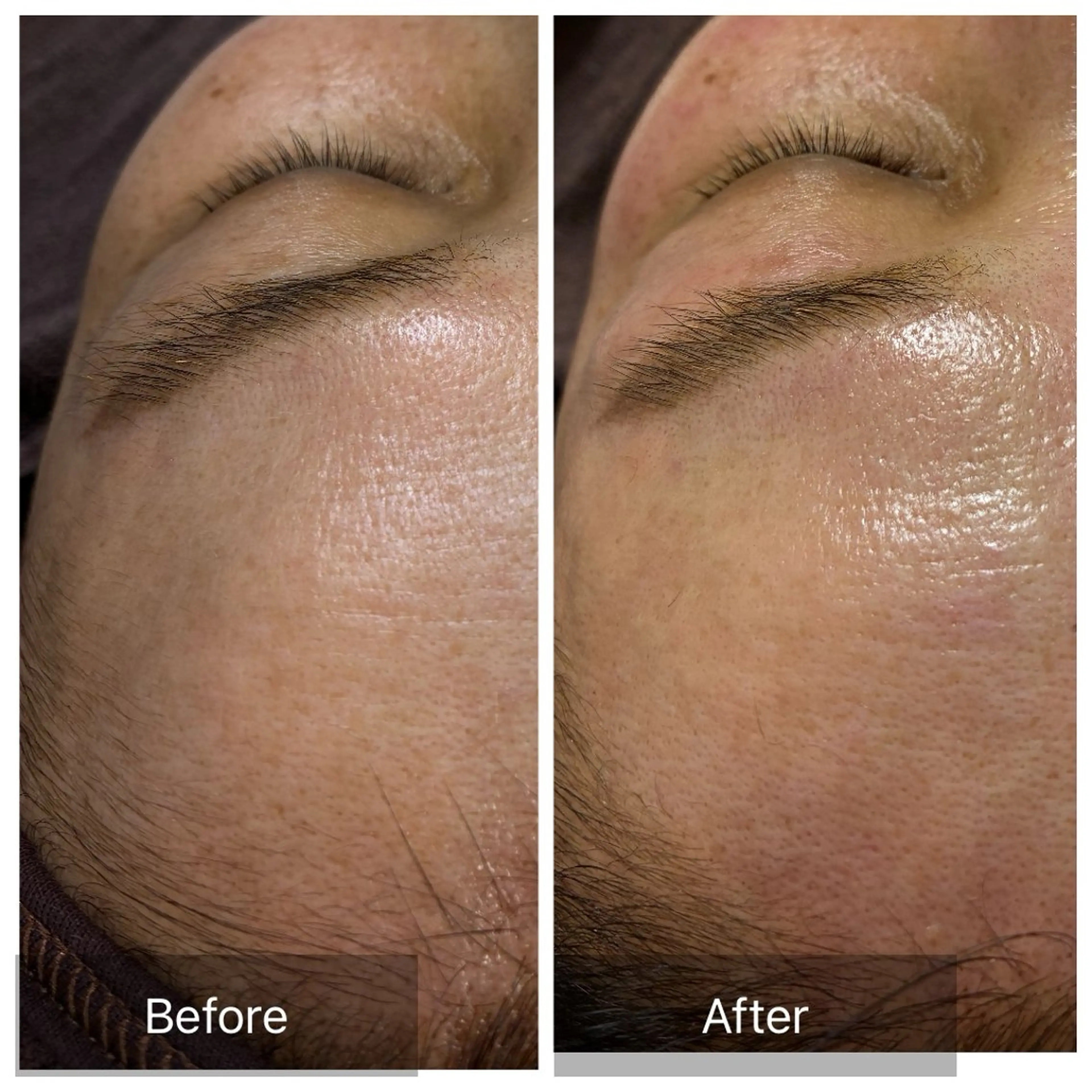 脱毛 産毛専門店 Bittoのエステ・リラクイメージ