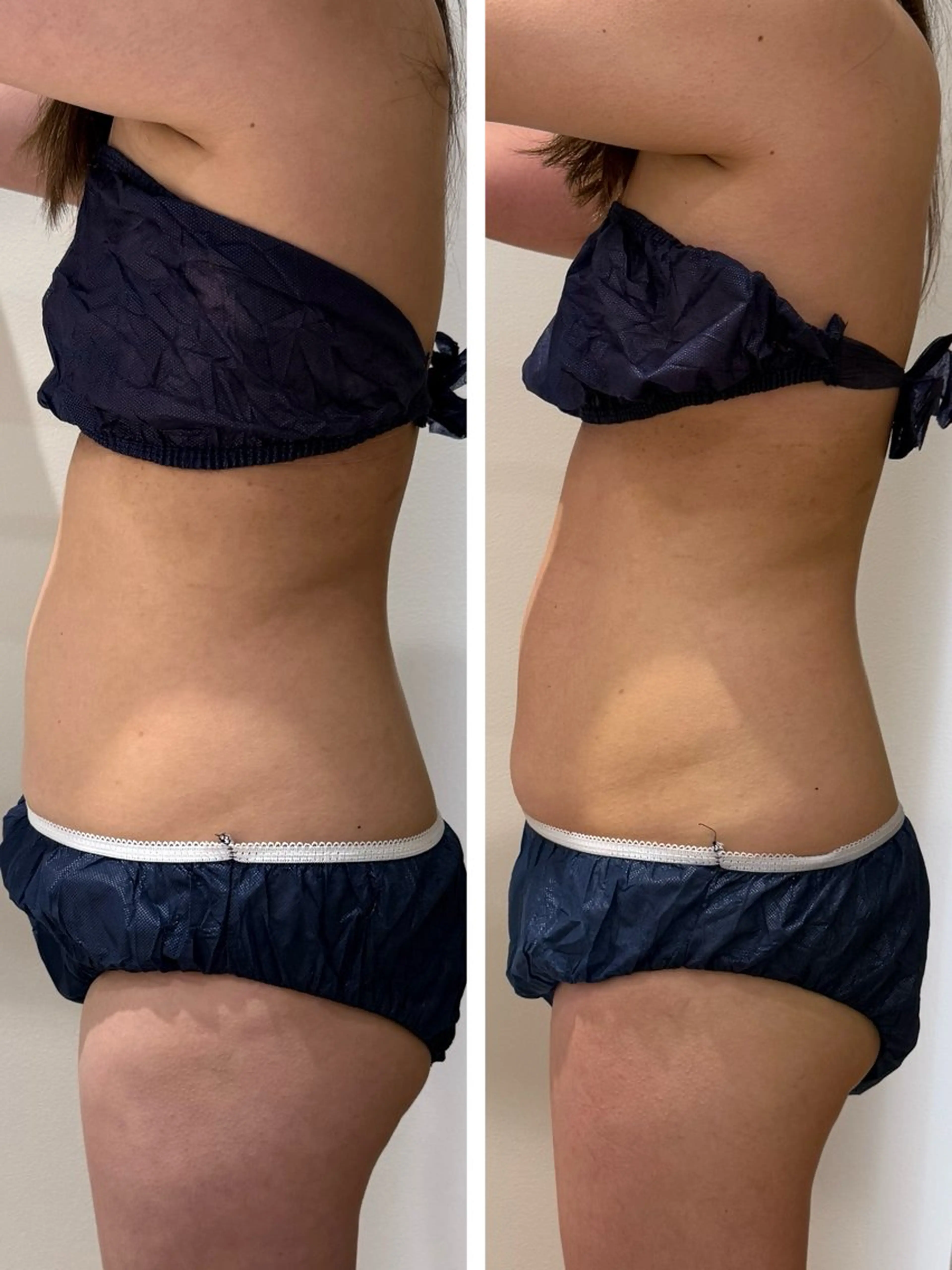 エステ beautysalon RAVIS所属・東大阪/韓国肌管理/ 痩身バスト専門店のエステ・リラクイメージ