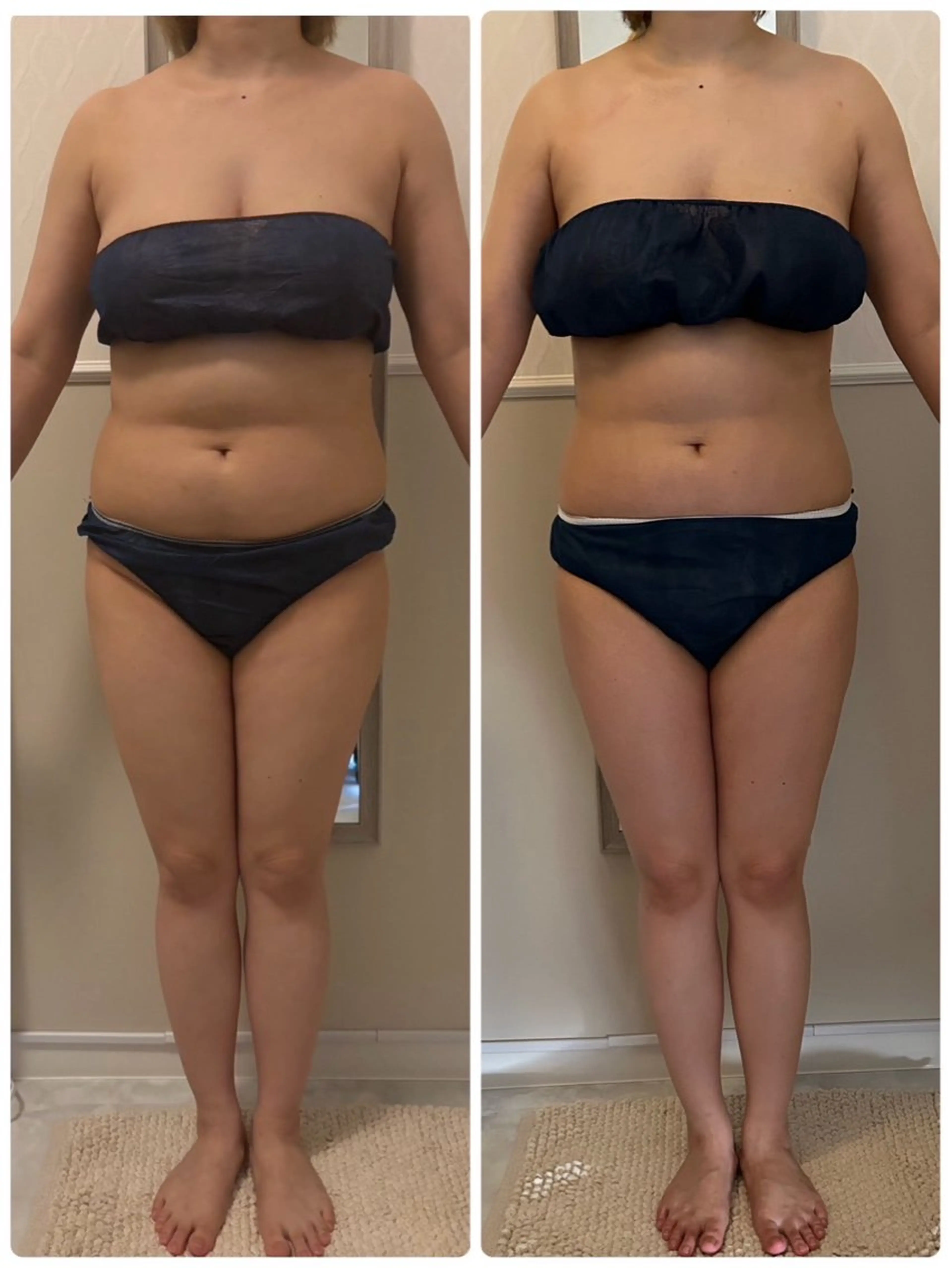 小顔美肌痩身サロン Ranのその他イメージ