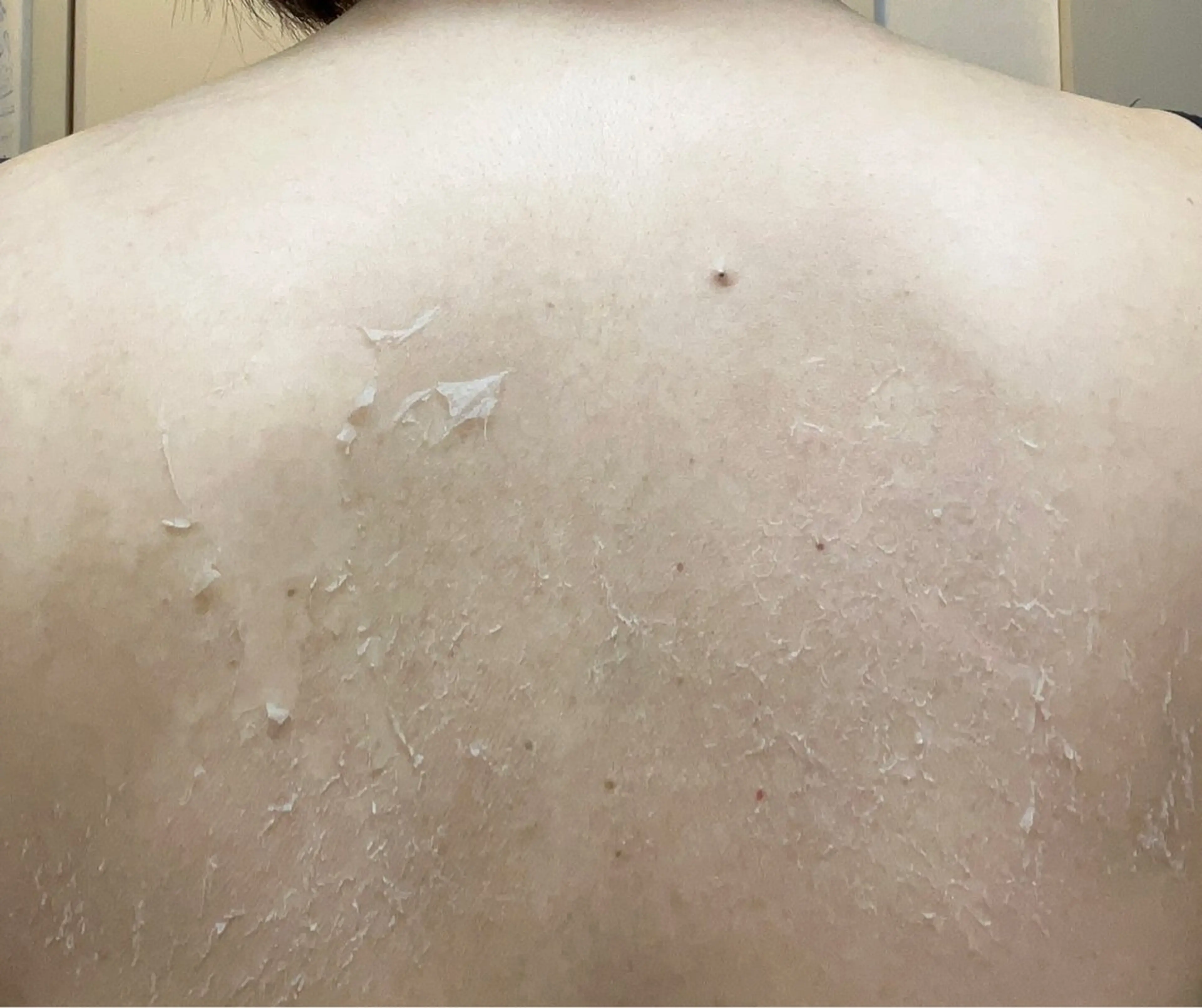 エステ clé skin 🌿ハーブピーリングのエステ・リラクイメージ