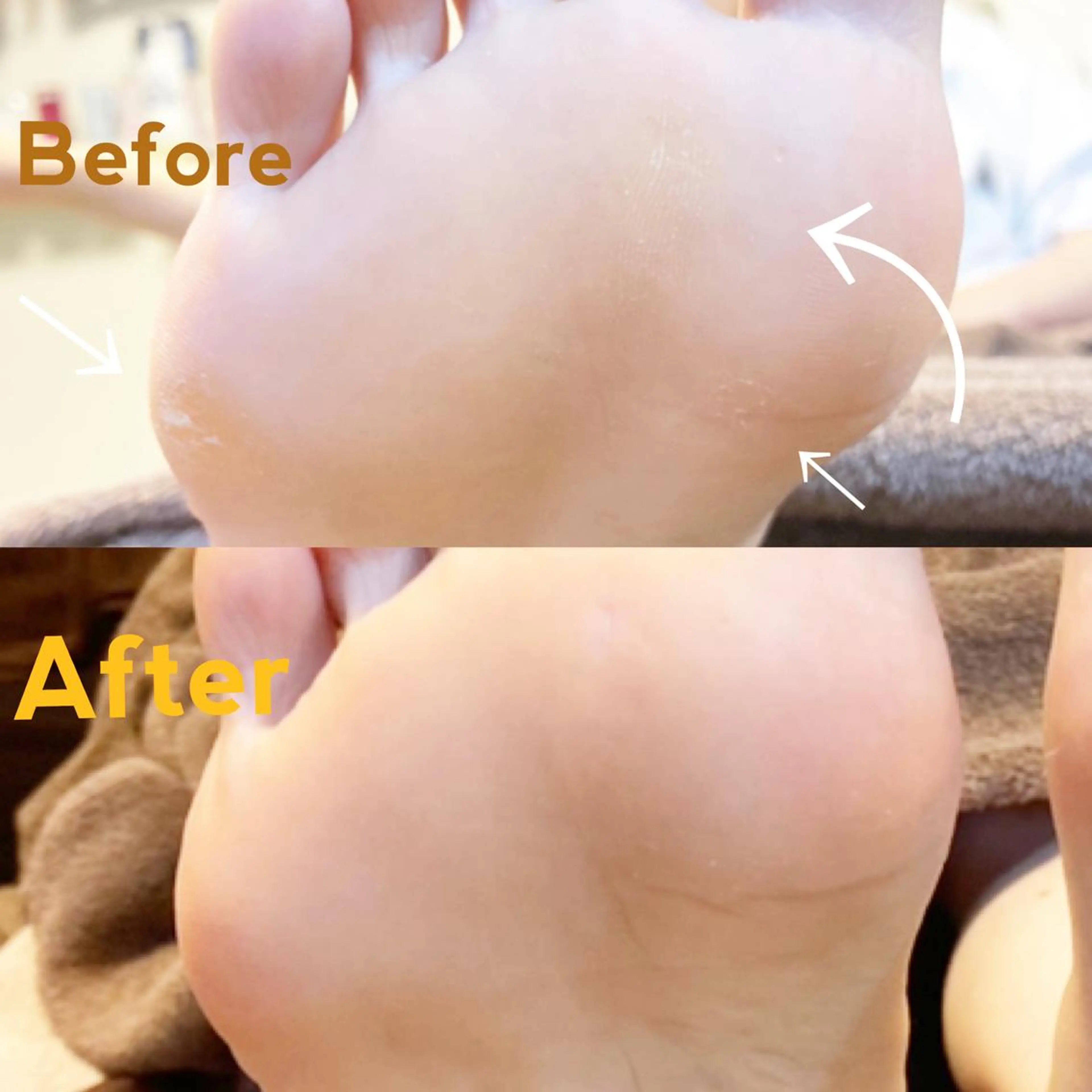 メンズ キッズ ネイル フットネイル その他 🌱 ま し お 🌱のその他イメージ