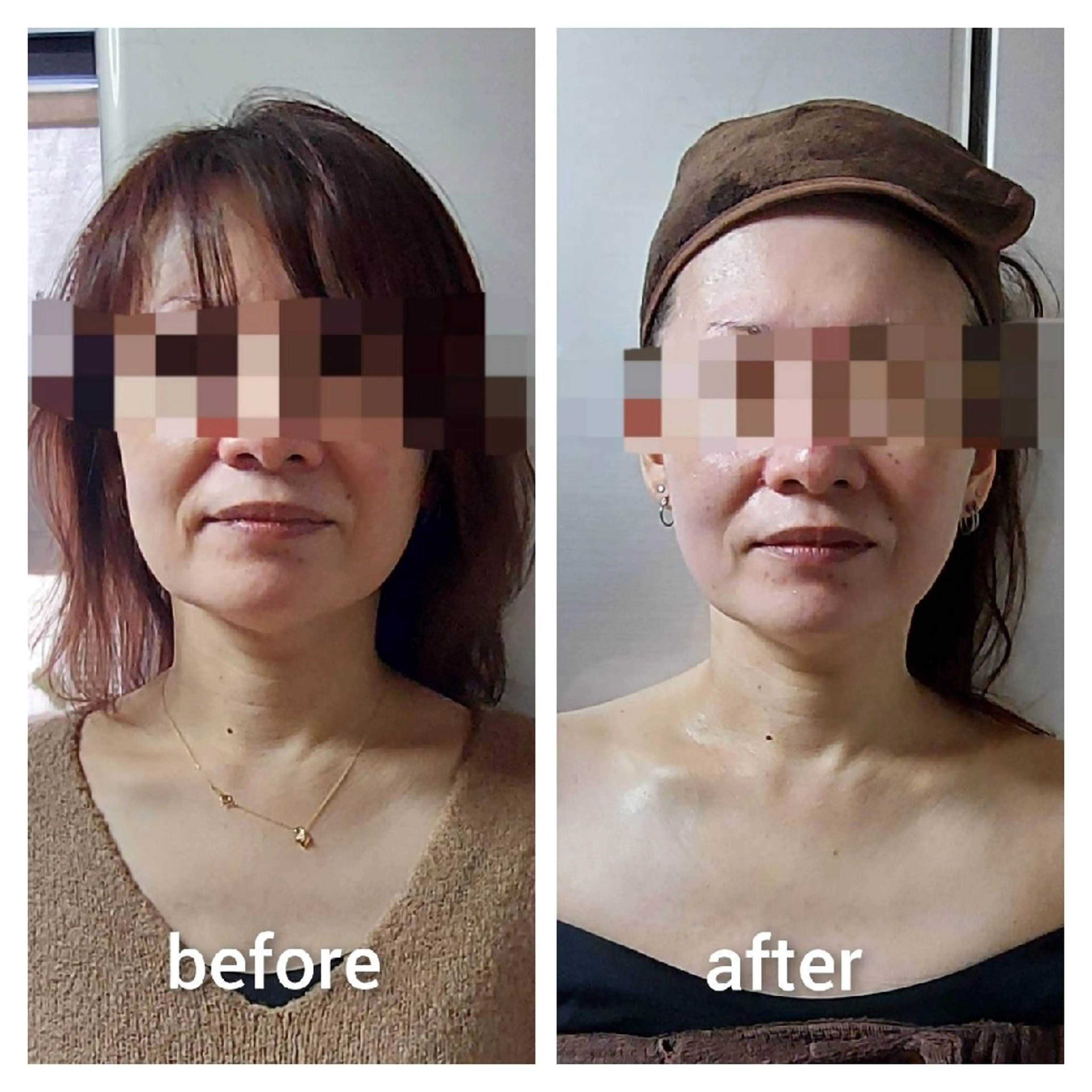 🌿ハーブピーリング TO BE HERBのエステ・リラクイメージ