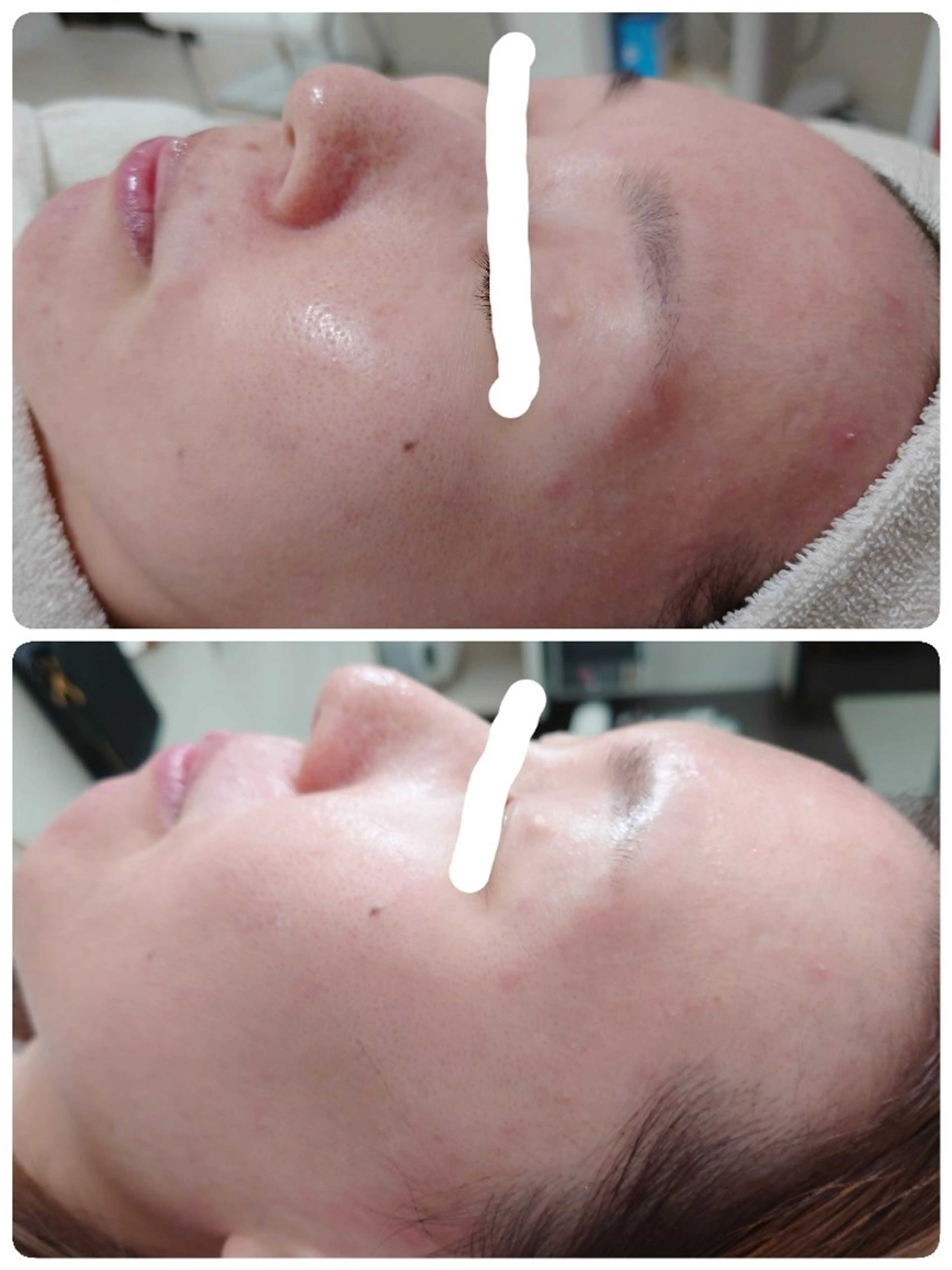 エステ Abe Yukaのエステ・リラクイメージ