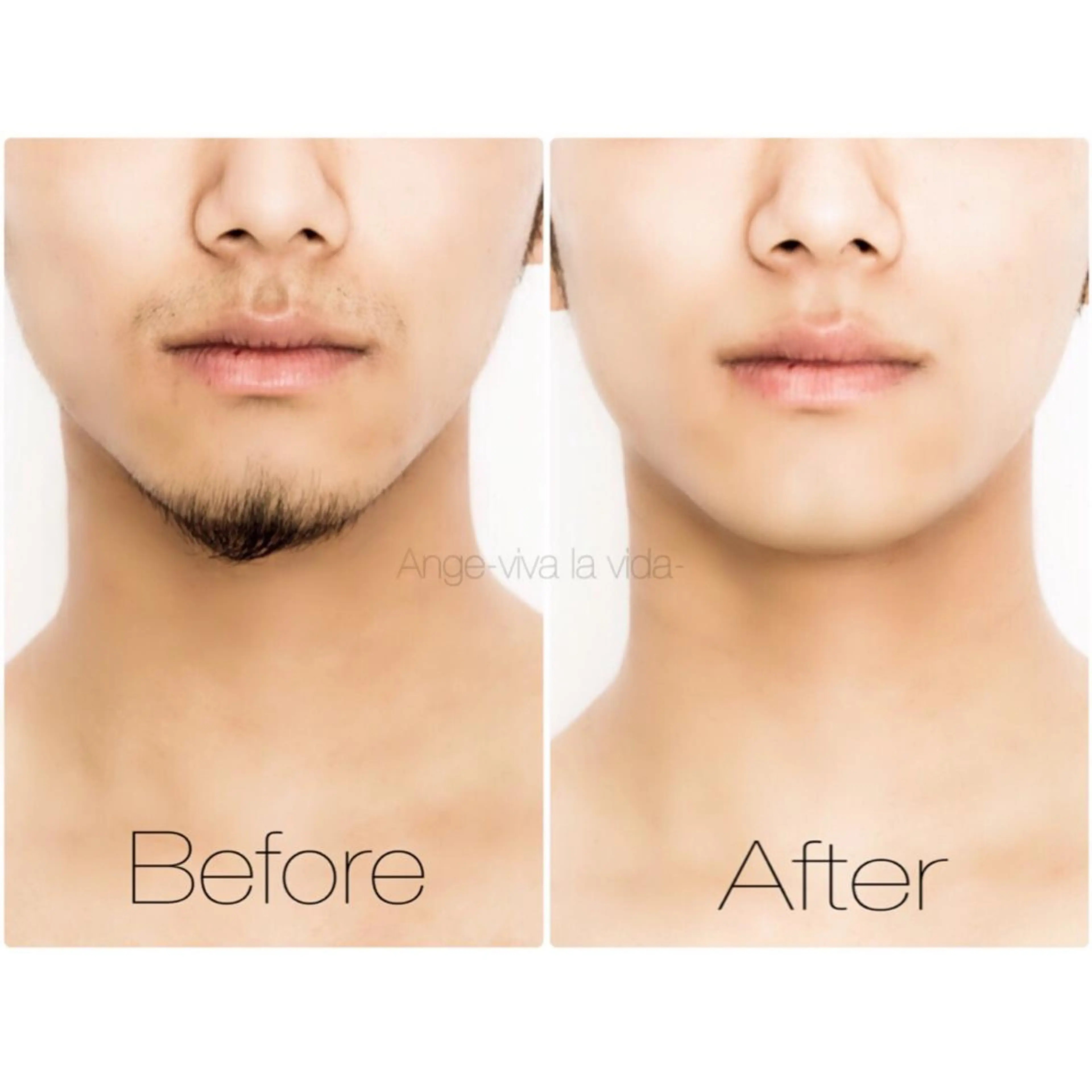 脱毛 Ange vivalavidaのエステ・リラクイメージ