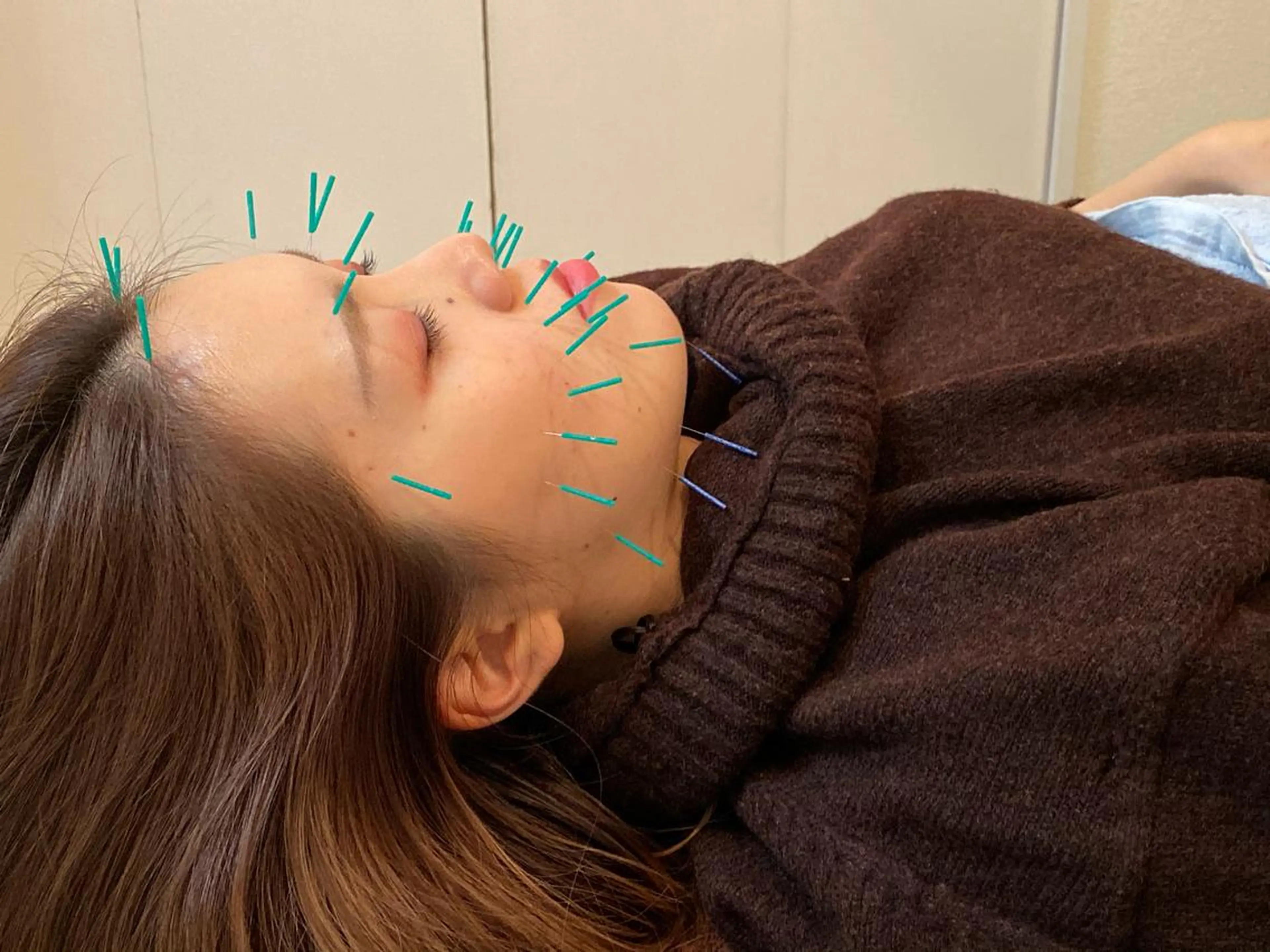 美容鍼 蕾【谷町六丁目】のエステ・リラクイメージ