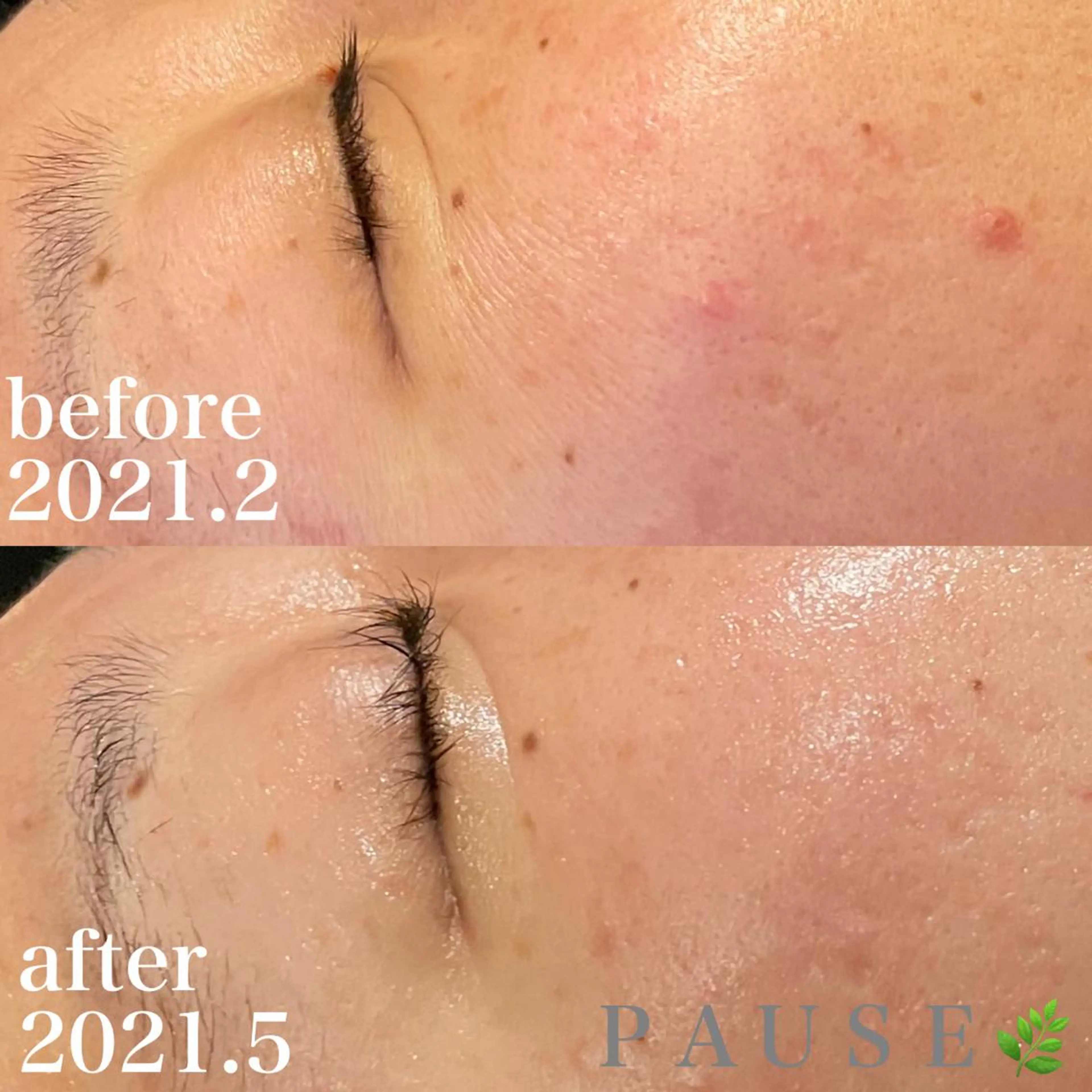 エステ 浜野 恵美のエステ・リラクイメージ