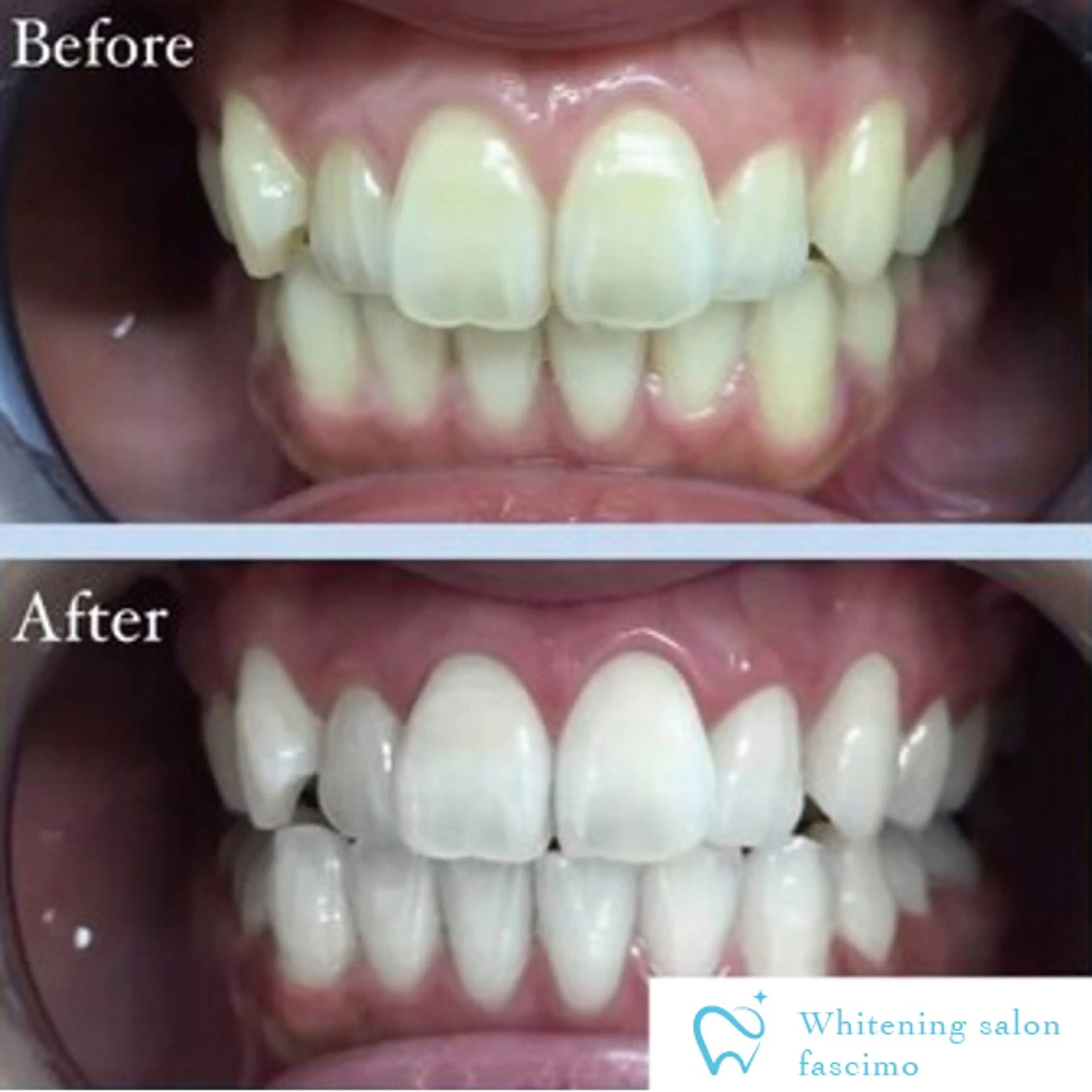 その他 ホワイトニングサロン fascimo新座店のその他イメージ