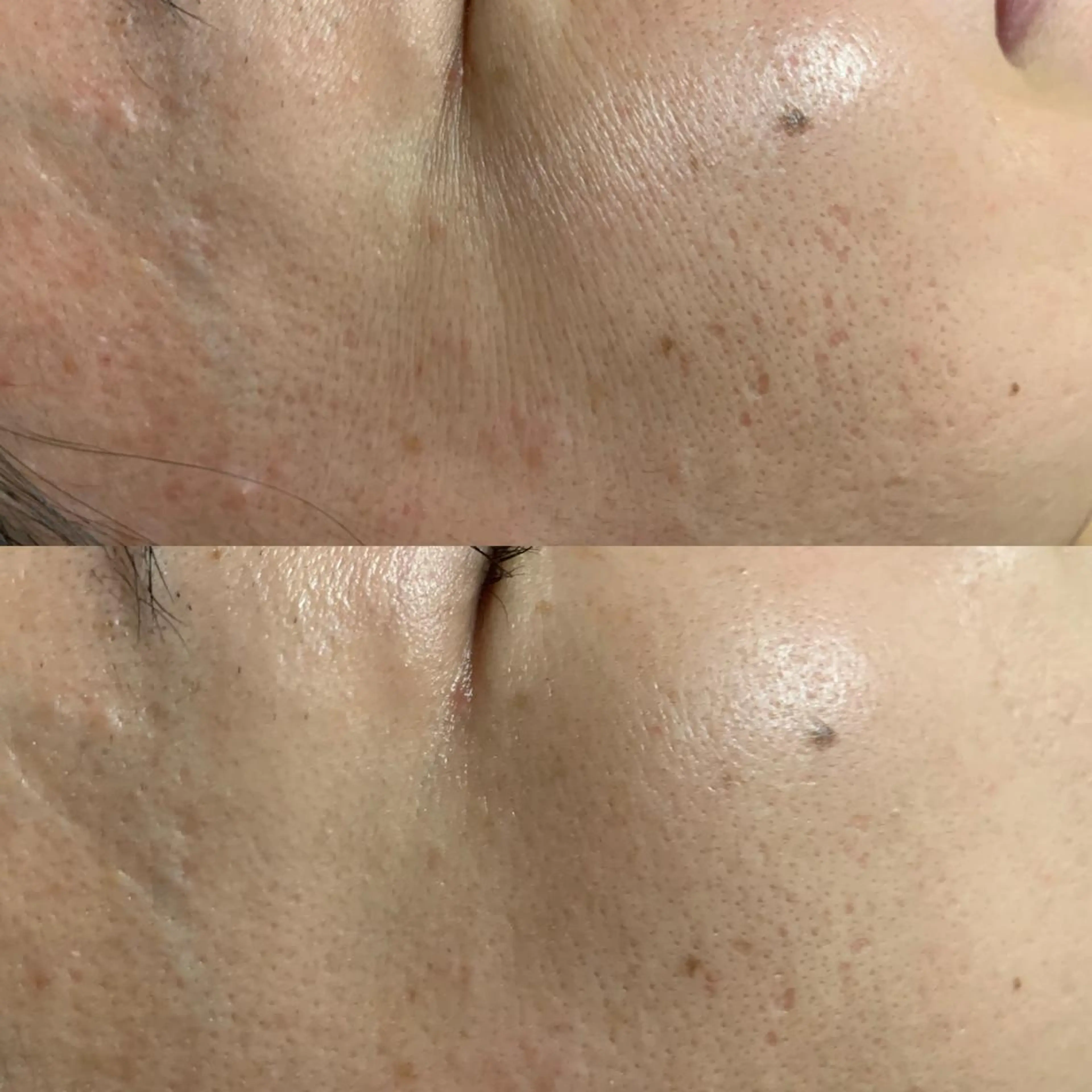 エステ 小顔専門店 桜Bisucuitのエステ・リラクイメージ