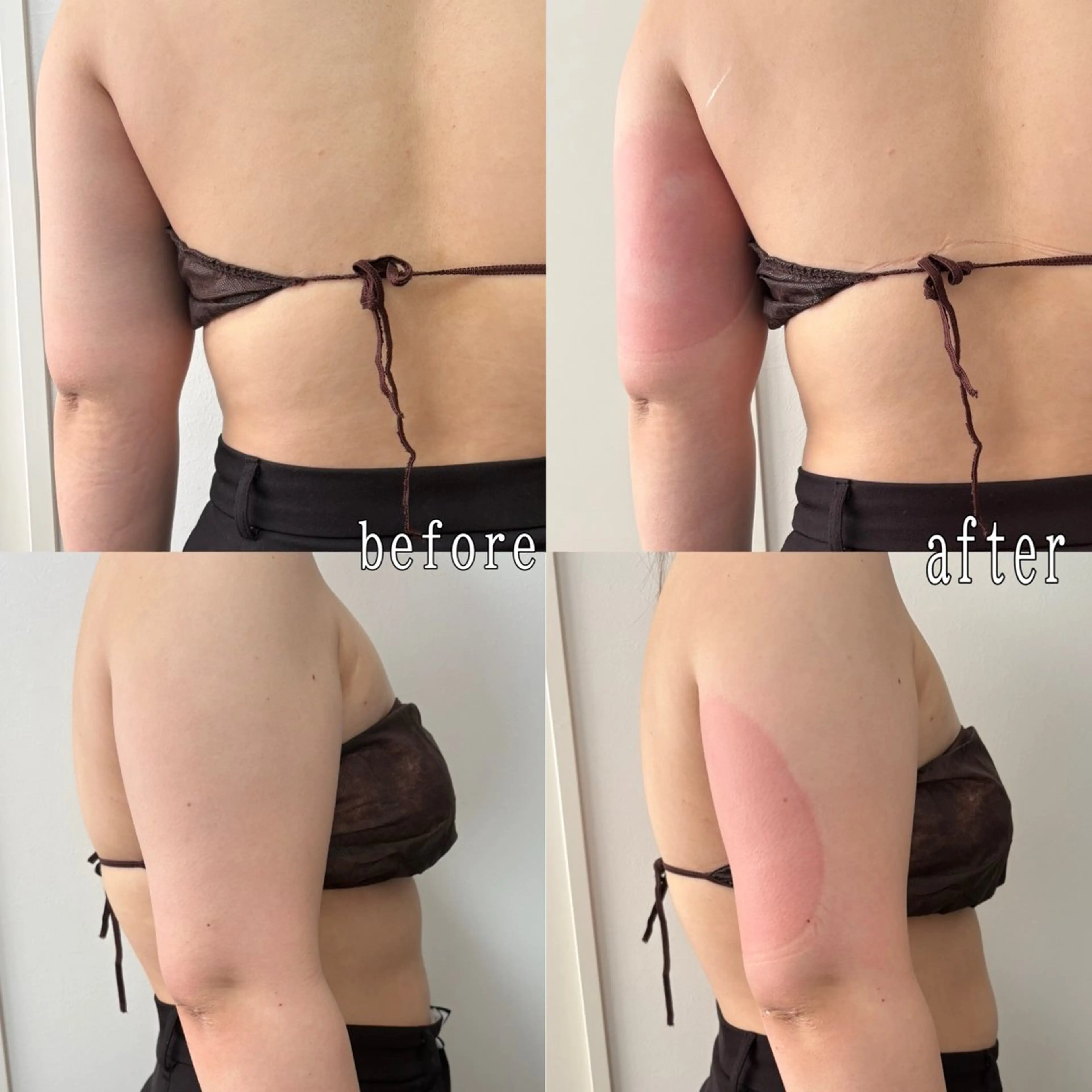 エステ Miiju.所属・石巻 冷却痩身 Miiju. 鈴木のエステ・リラクイメージ