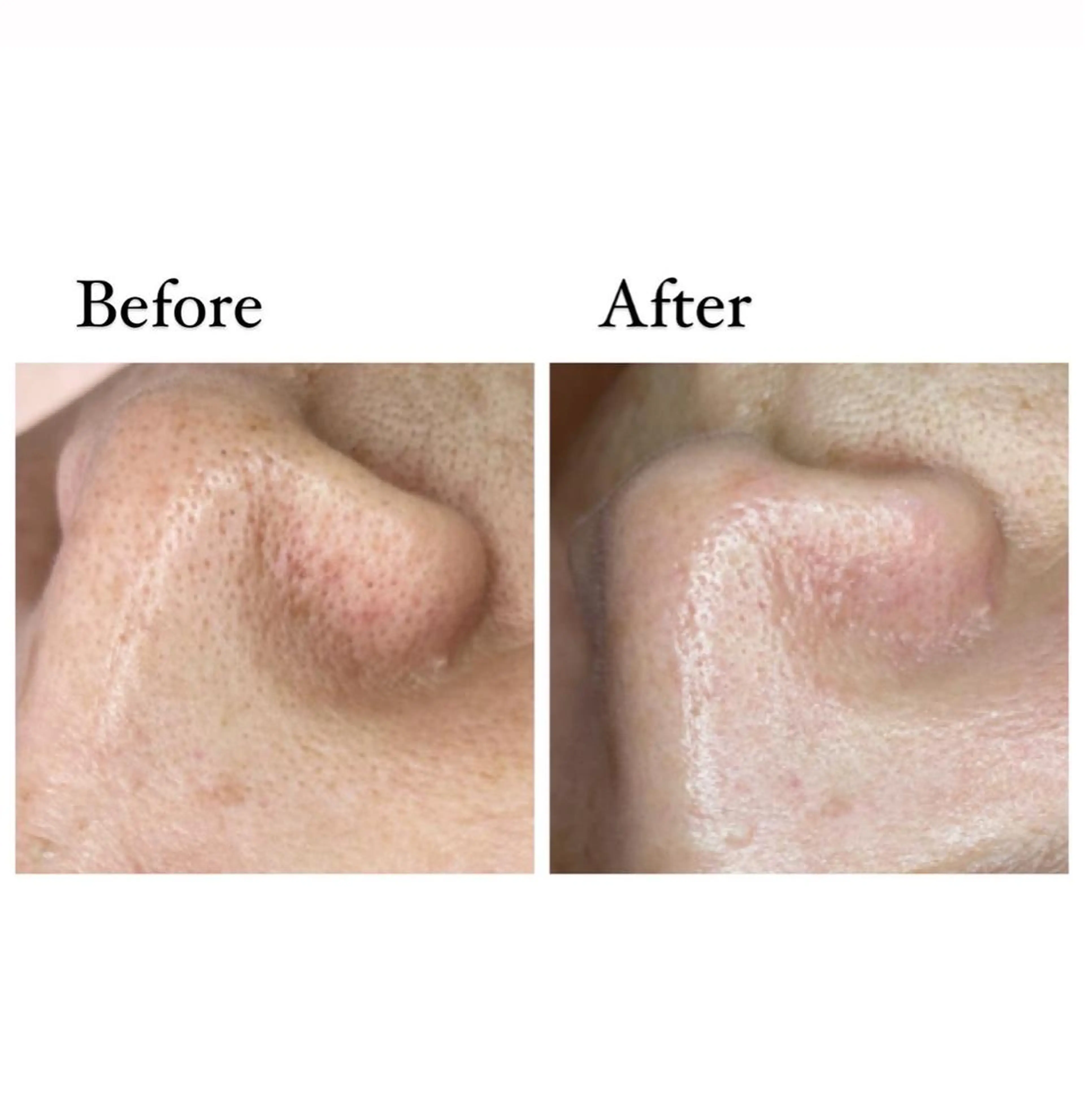 ニキビ/敏感肌/乾燥 Lilyauraのエステ・リラクイメージ