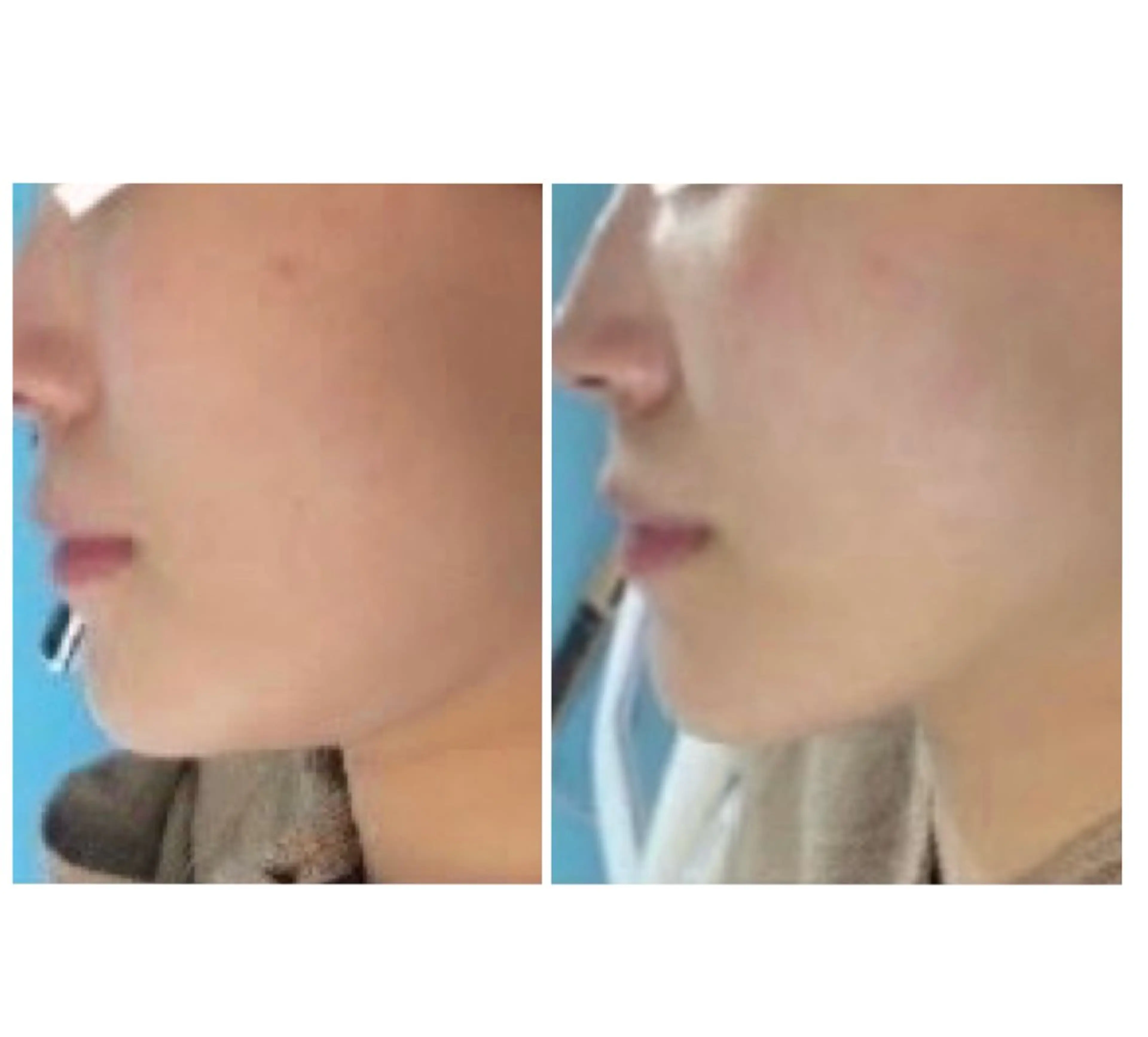 NAZ  (ナーズ)のエステ・リラクイメージ