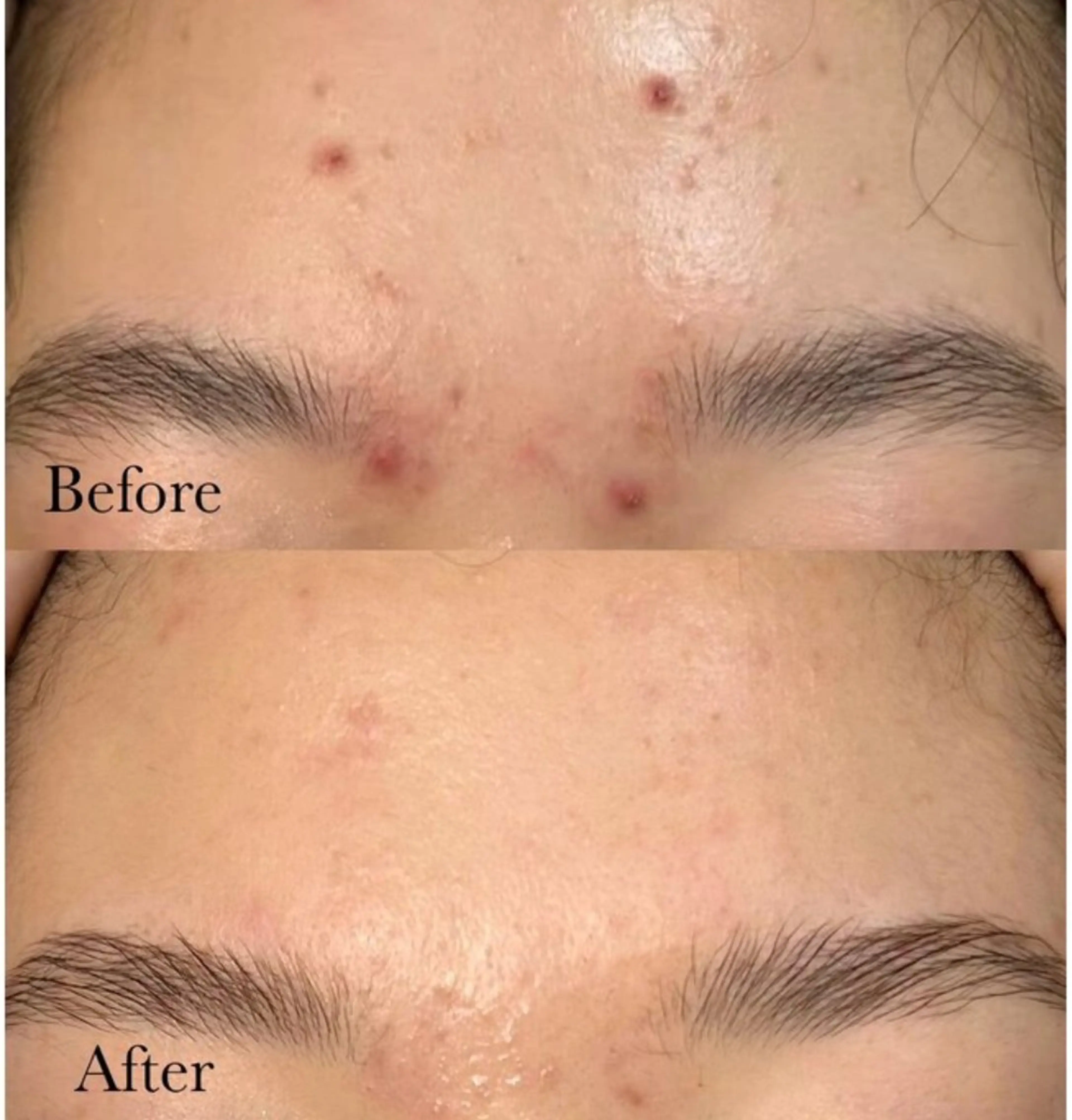 マツエク・マツパ エステ リラク 愛維美水光美肌専門店 メンズレディースokのエステ・リラクイメージ