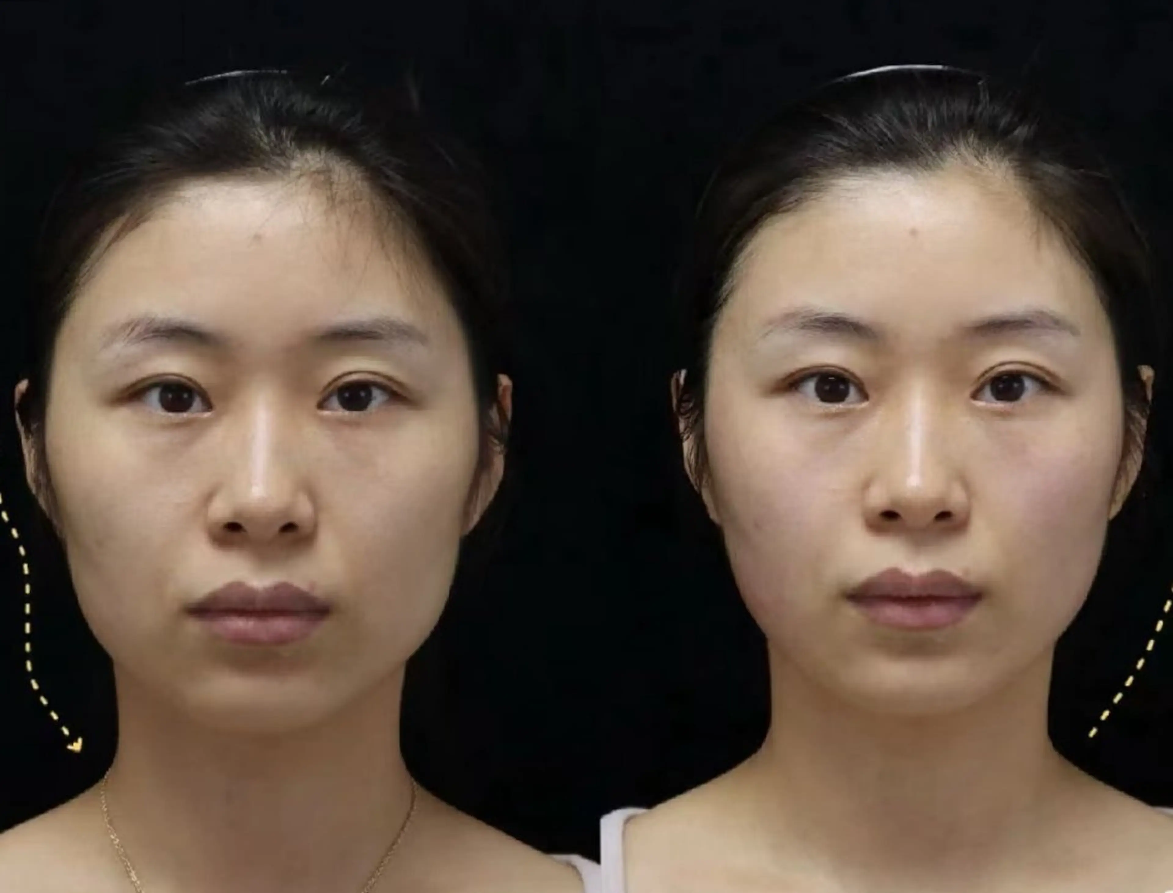 その他 aliaハーブ水光店 エステティシャン募集のエステ・リラクイメージ