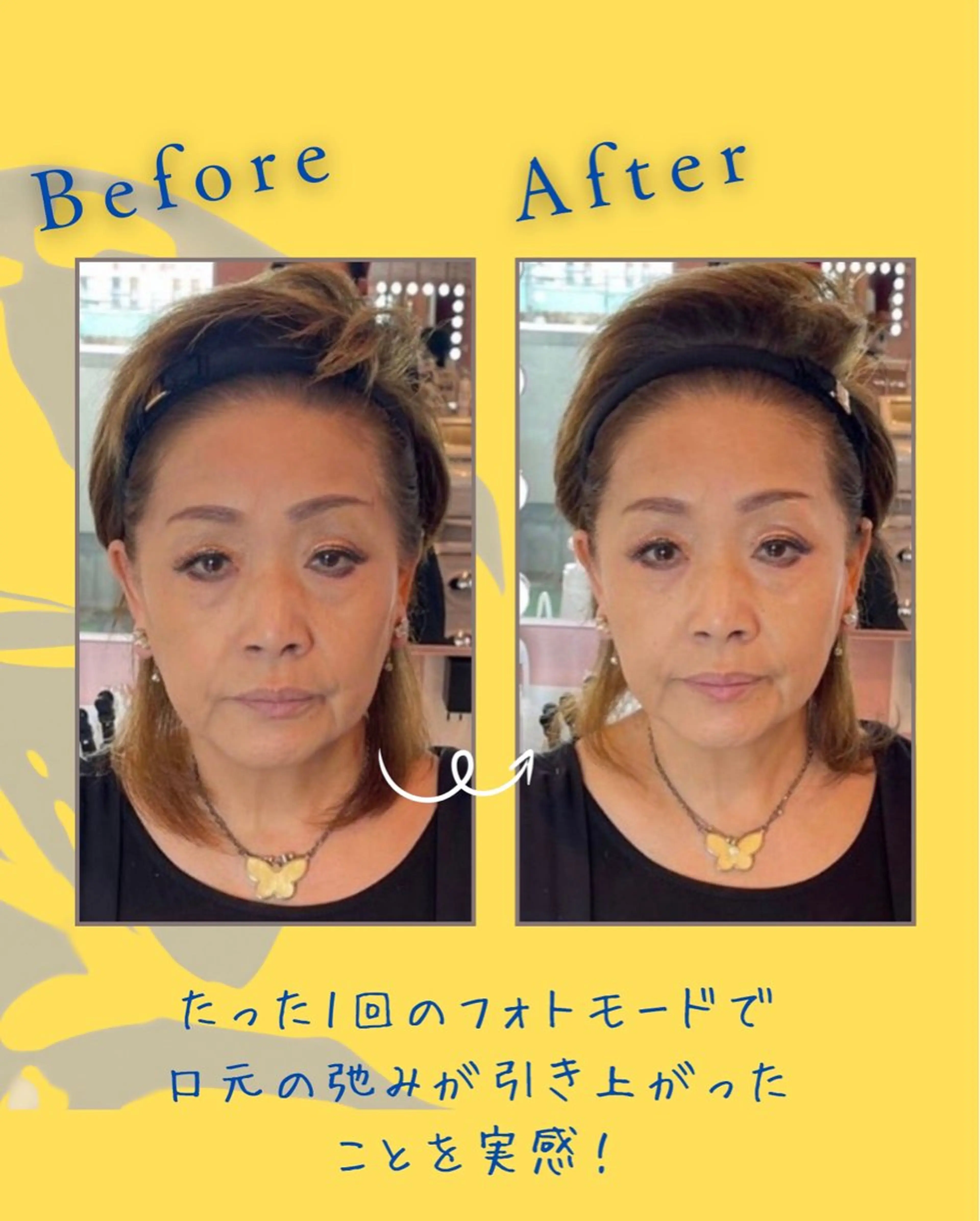 ヘアサロンLISALISA所属・セルフ脱毛・光エステ LISALISAのエステ・リラクイメージ