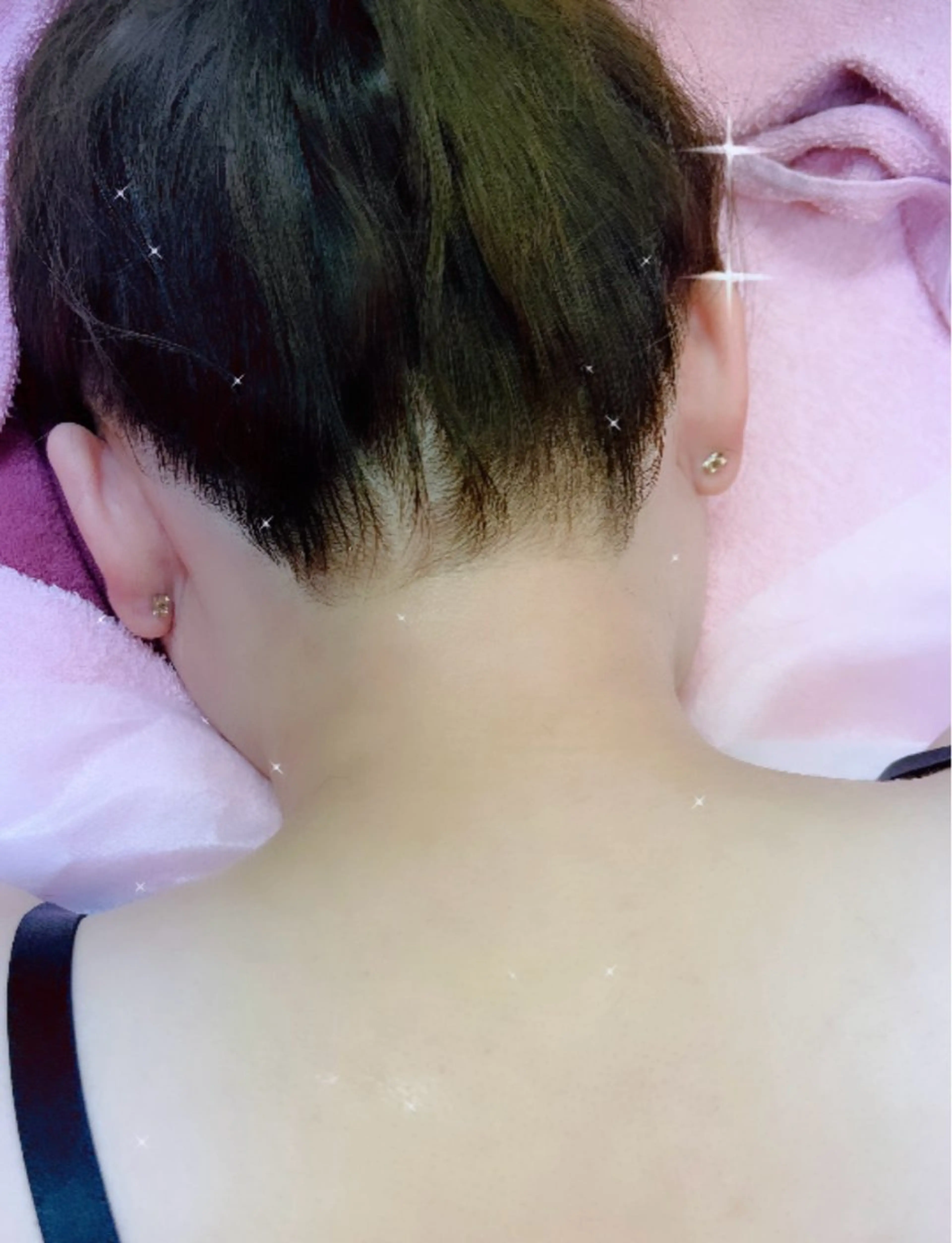 うなじ脱毛の写真