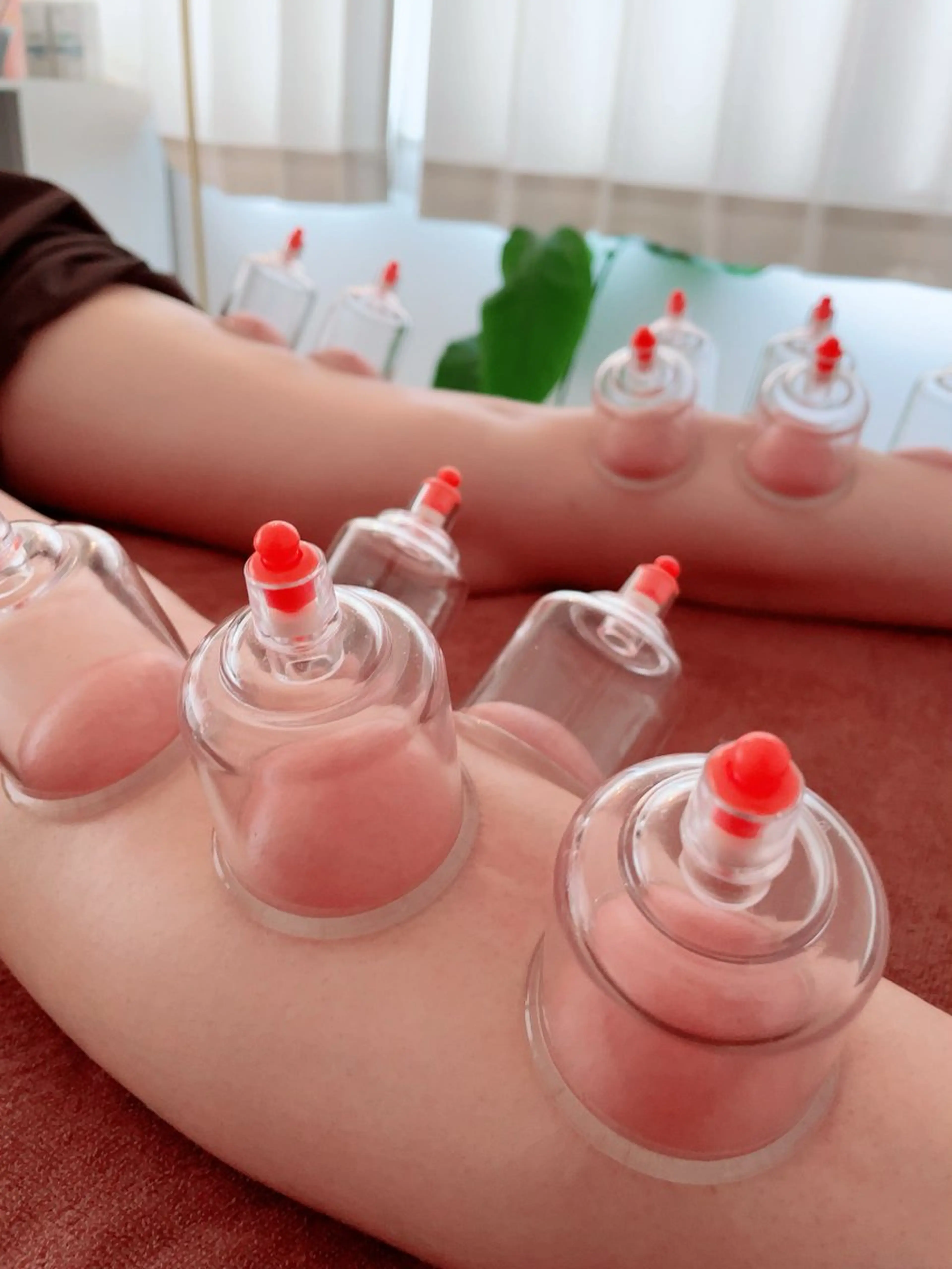 美容鍼＆鍼灸サロン 鍼Glitter.岡山駅前店所属・田中 美奈のエステ・リラクイメージ