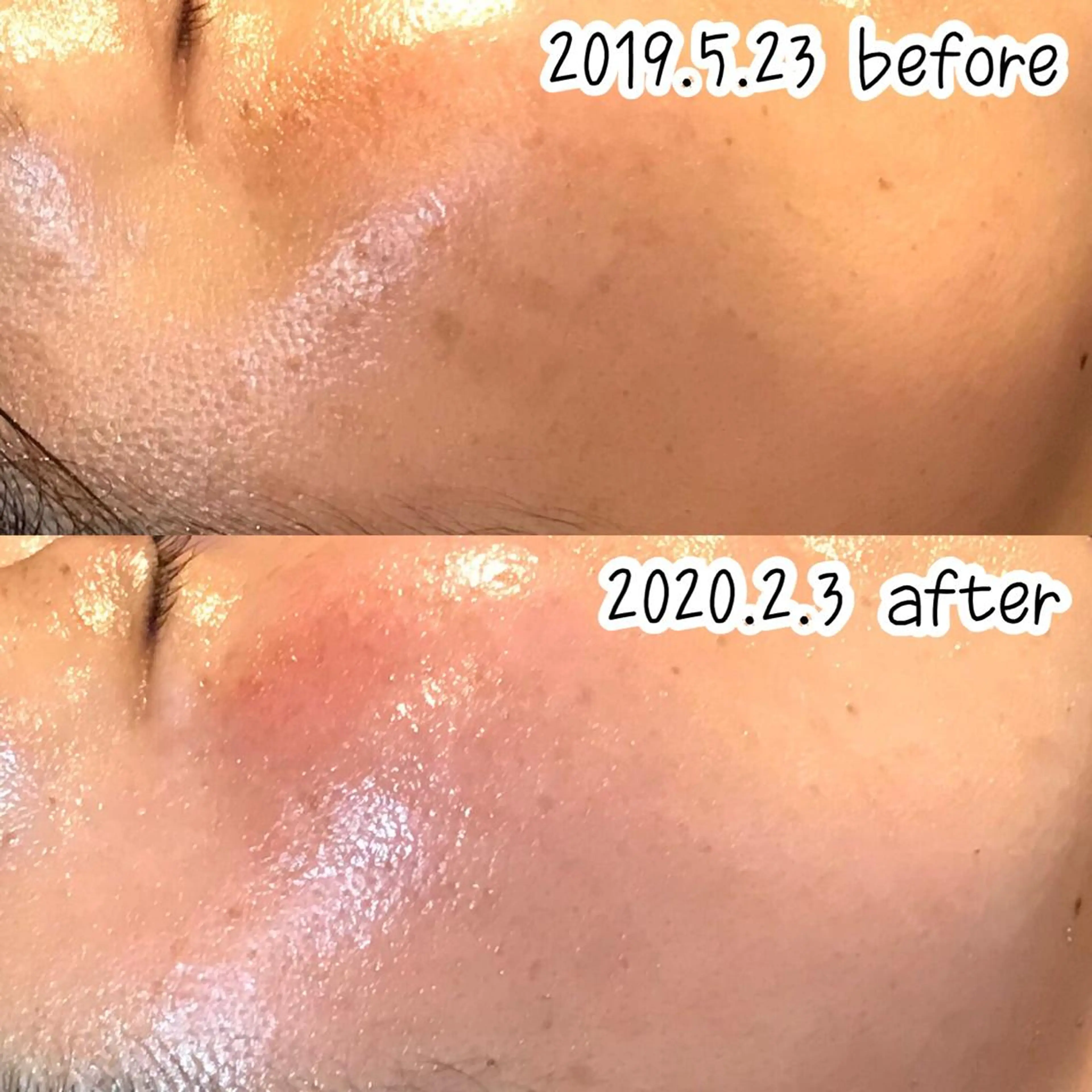 エステ 浜野 恵美のエステ・リラクイメージ