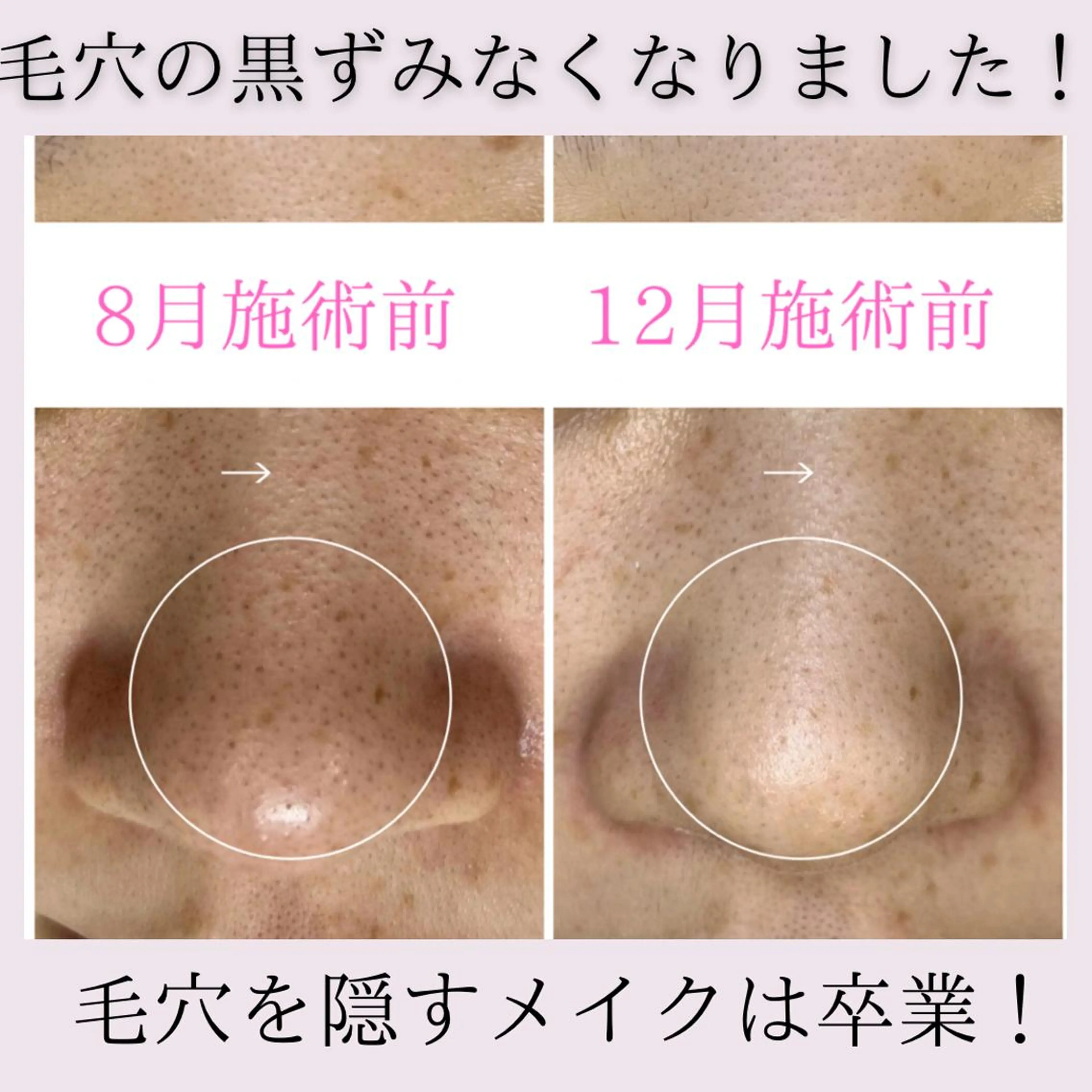 茨城土浦 つくば毛穴 ケア専門サロンのエステ・リラクイメージ