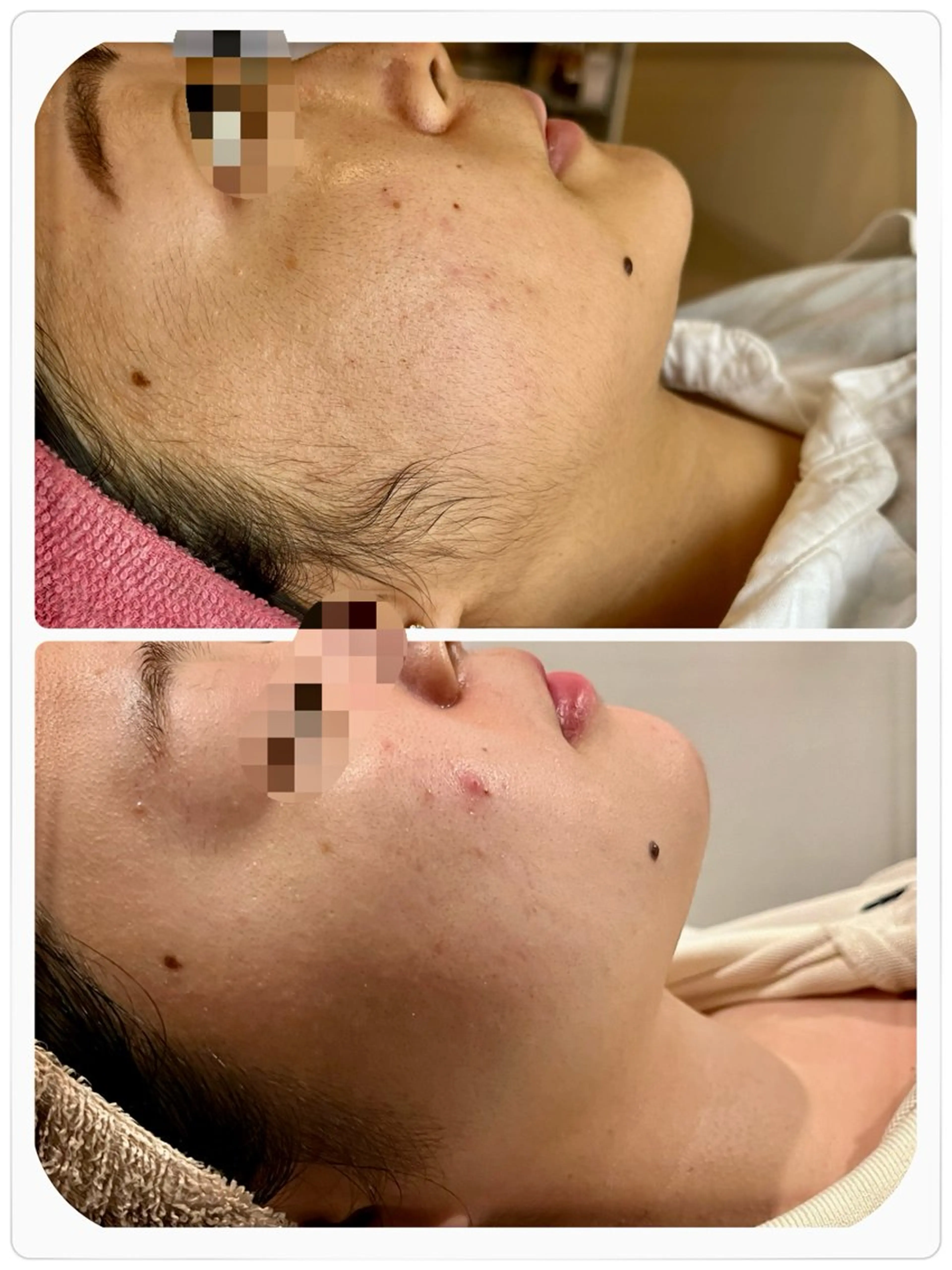 脱毛 【リベルハーブピーリング認定店】敏感肌・美白脱毛専門店Dione立川店所属・Dione 立川店のエステ・リラクイメージ